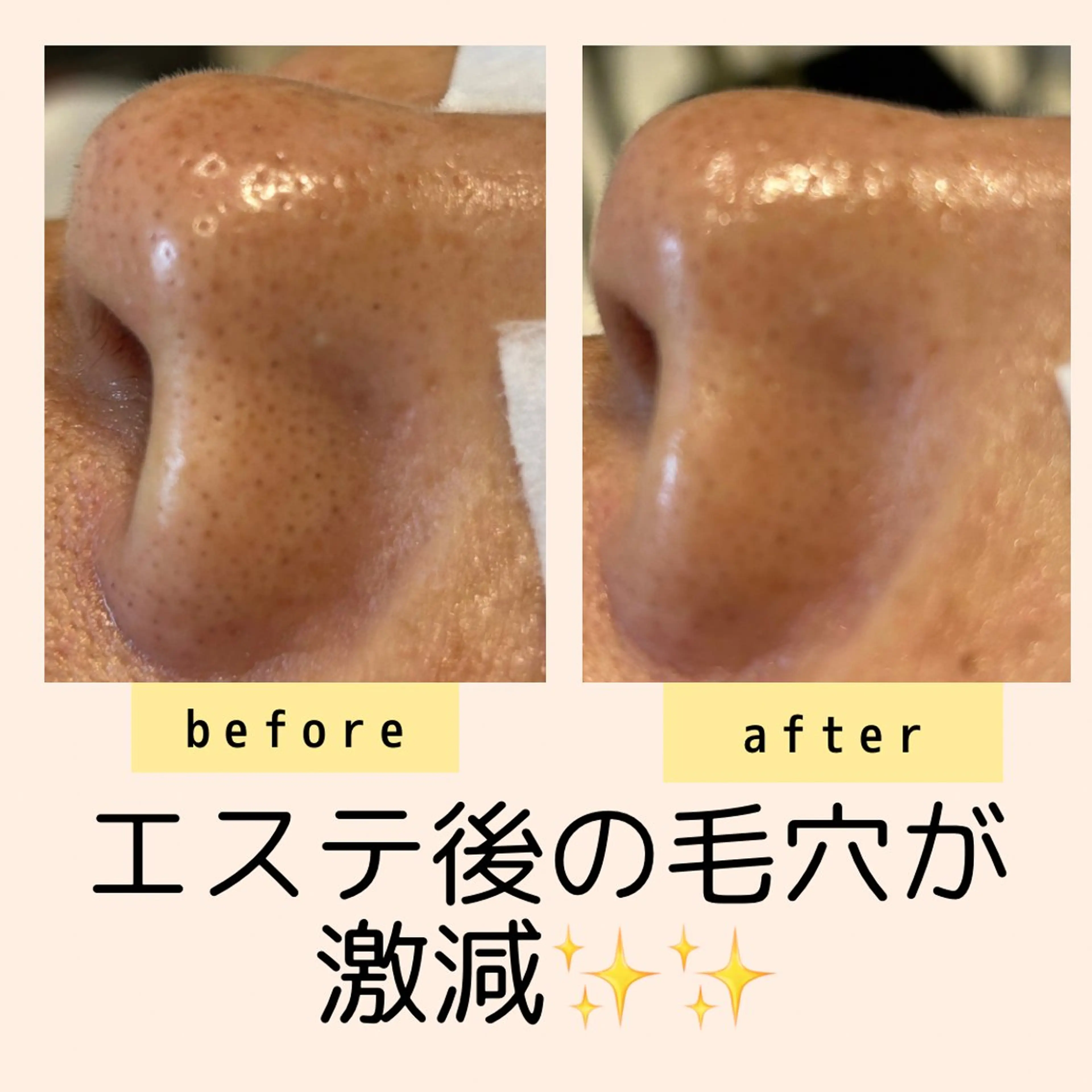 エステ 小顔・毛穴・たるみ ネイル　似内真樹のエステ・リラクイメージ