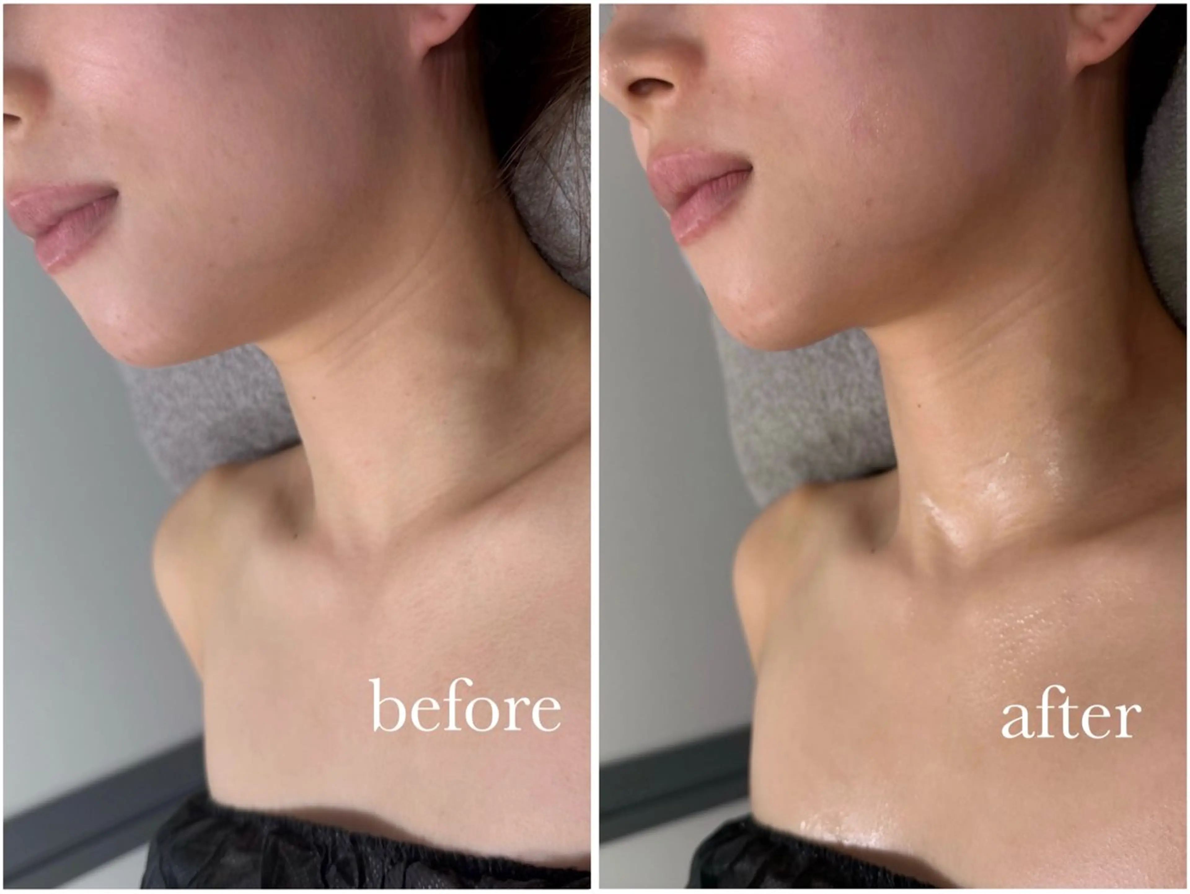 【都度払い】重力に負けない肌へ◎シワ・たるみにお悩みの方へ[カウンセリングからお客様に合ったメニューを相談]の写真