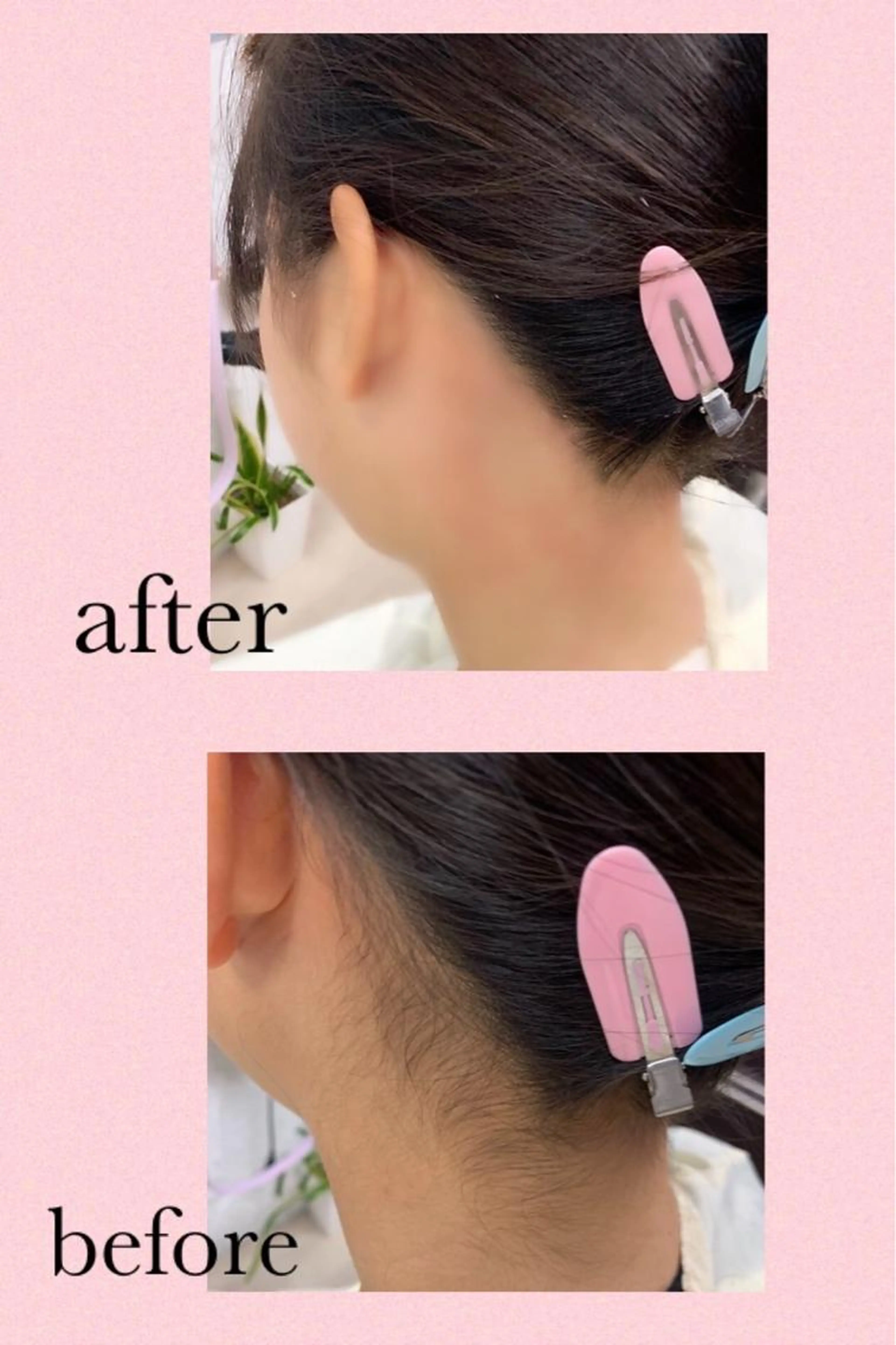 🍐うなじWax脱毛🍑気になるムダ毛無くしませんか❓ レディース&メンズ◇60分～90分の写真