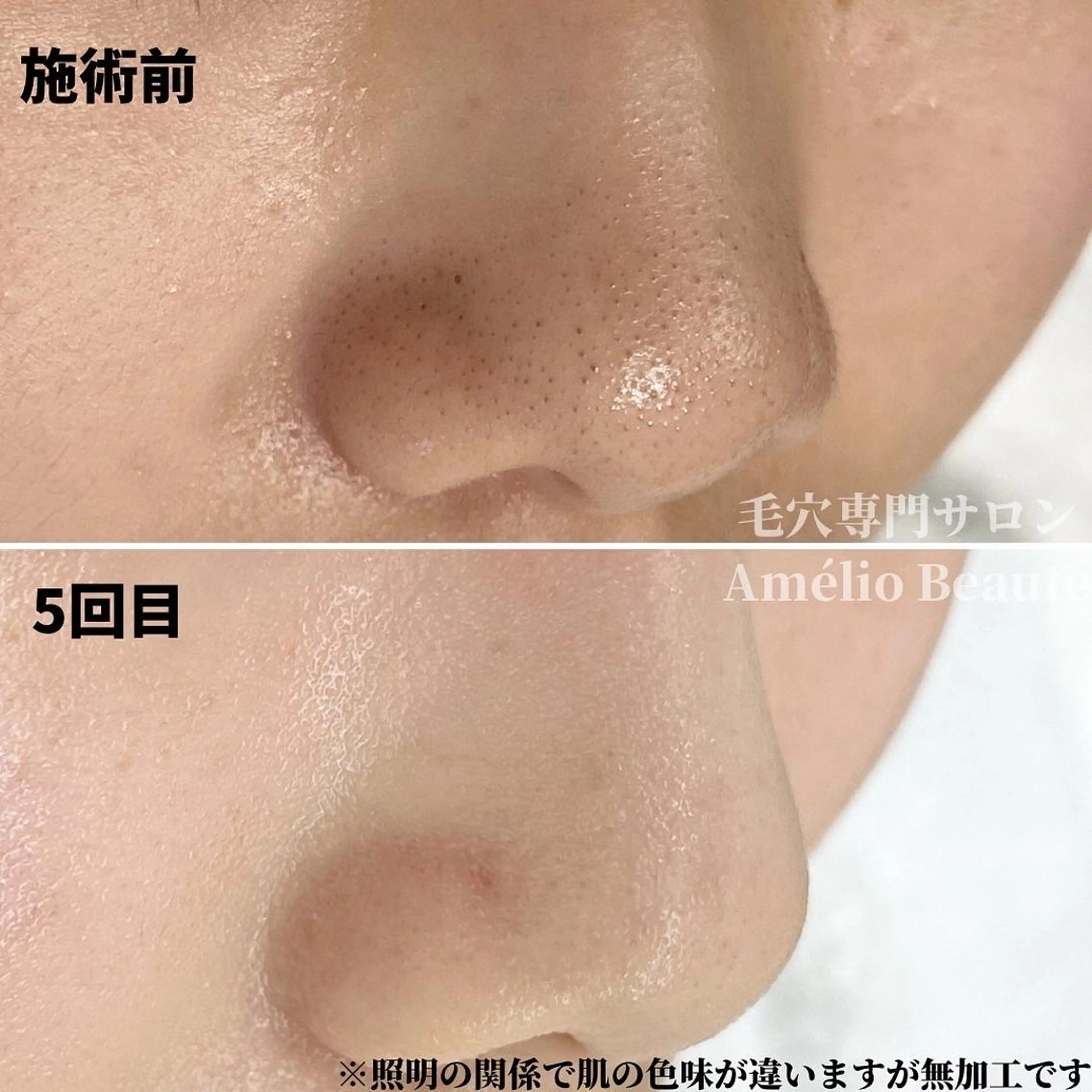 キッズ 毛穴ケア専門サロン アメリオボーテのその他イメージ