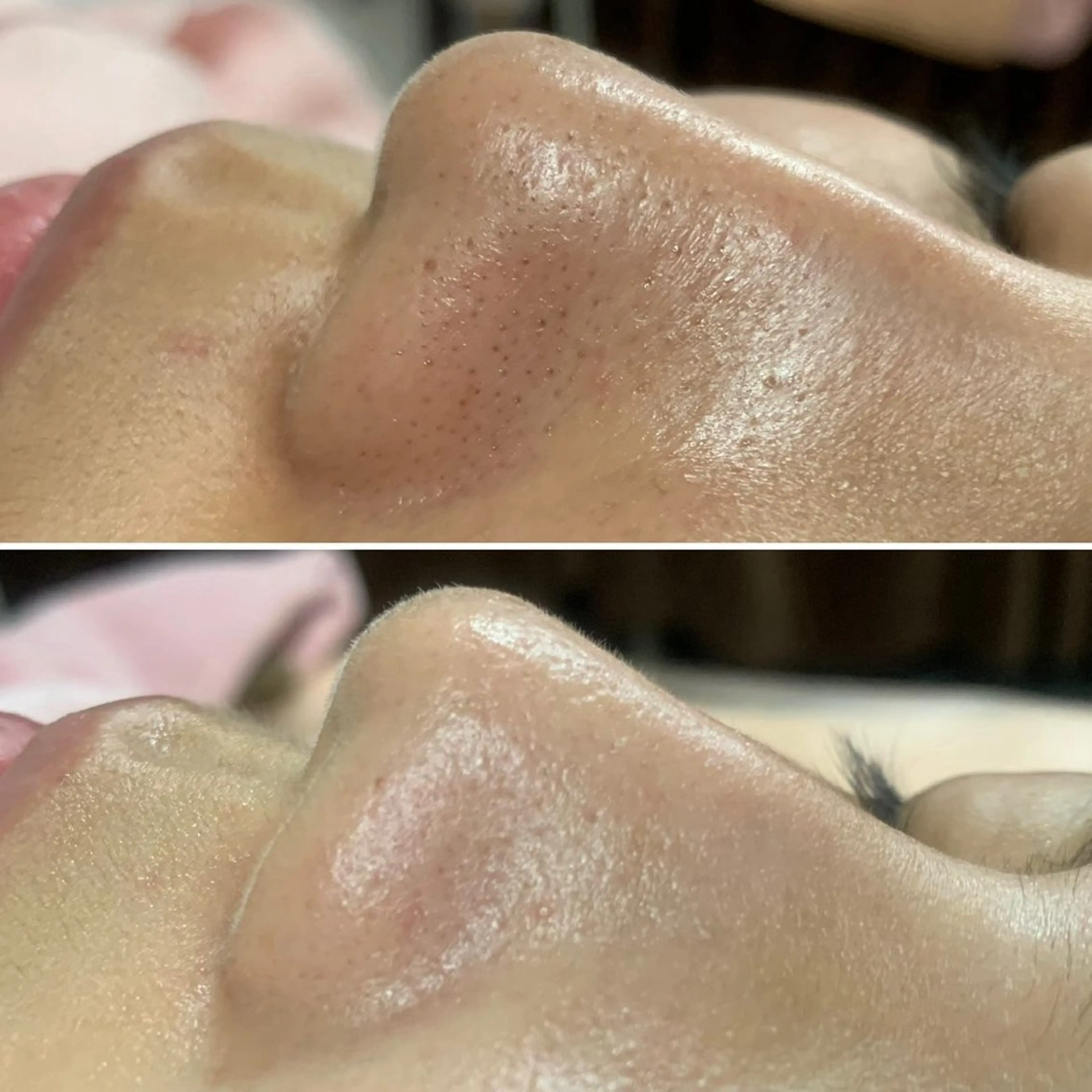 aroma  YURARI所属・韓国艶美人// 毛穴ケア🌹のエステ・リラクイメージ