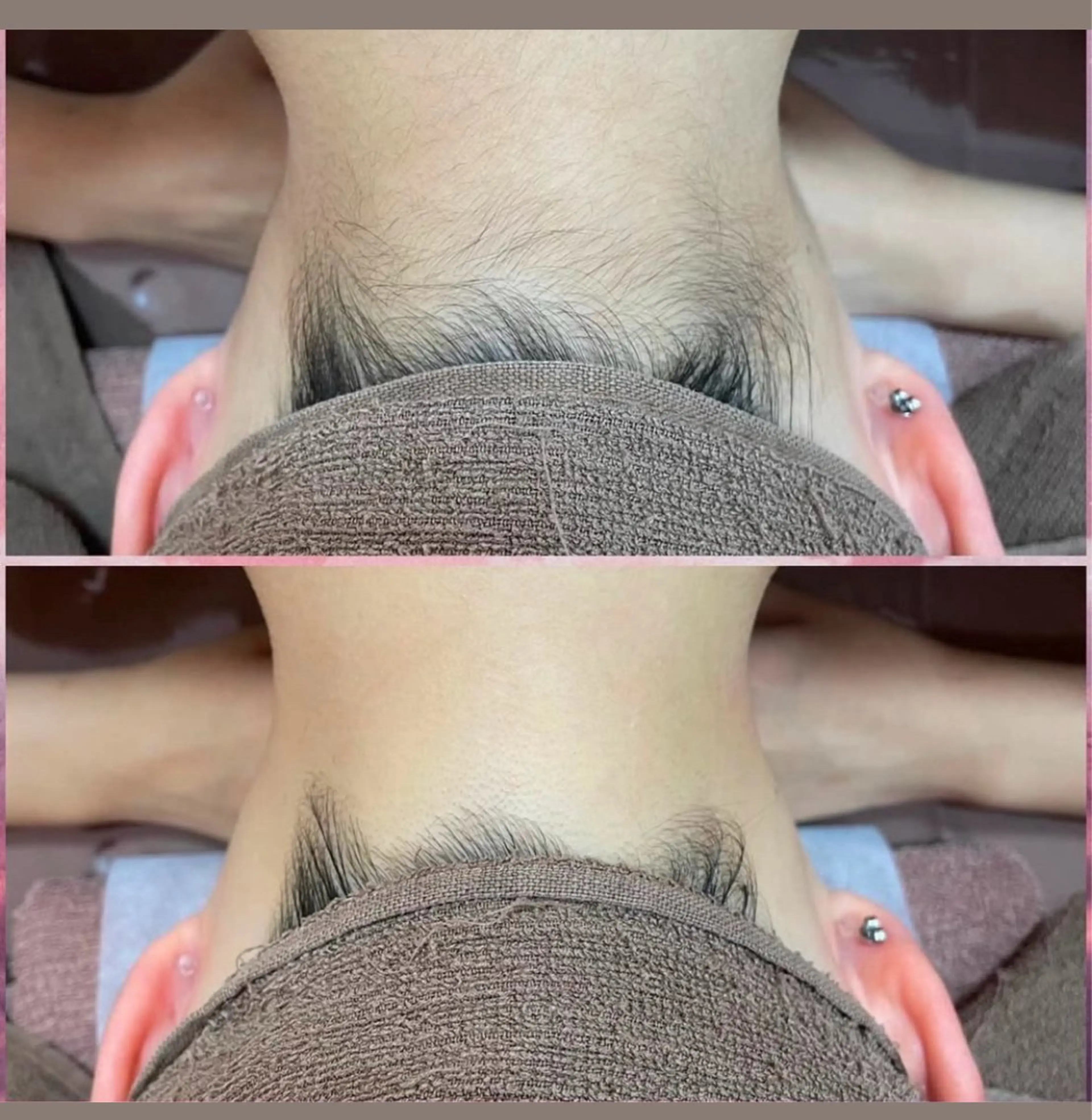 脱毛 美肌脱毛サロン muroのエステ・リラクイメージ