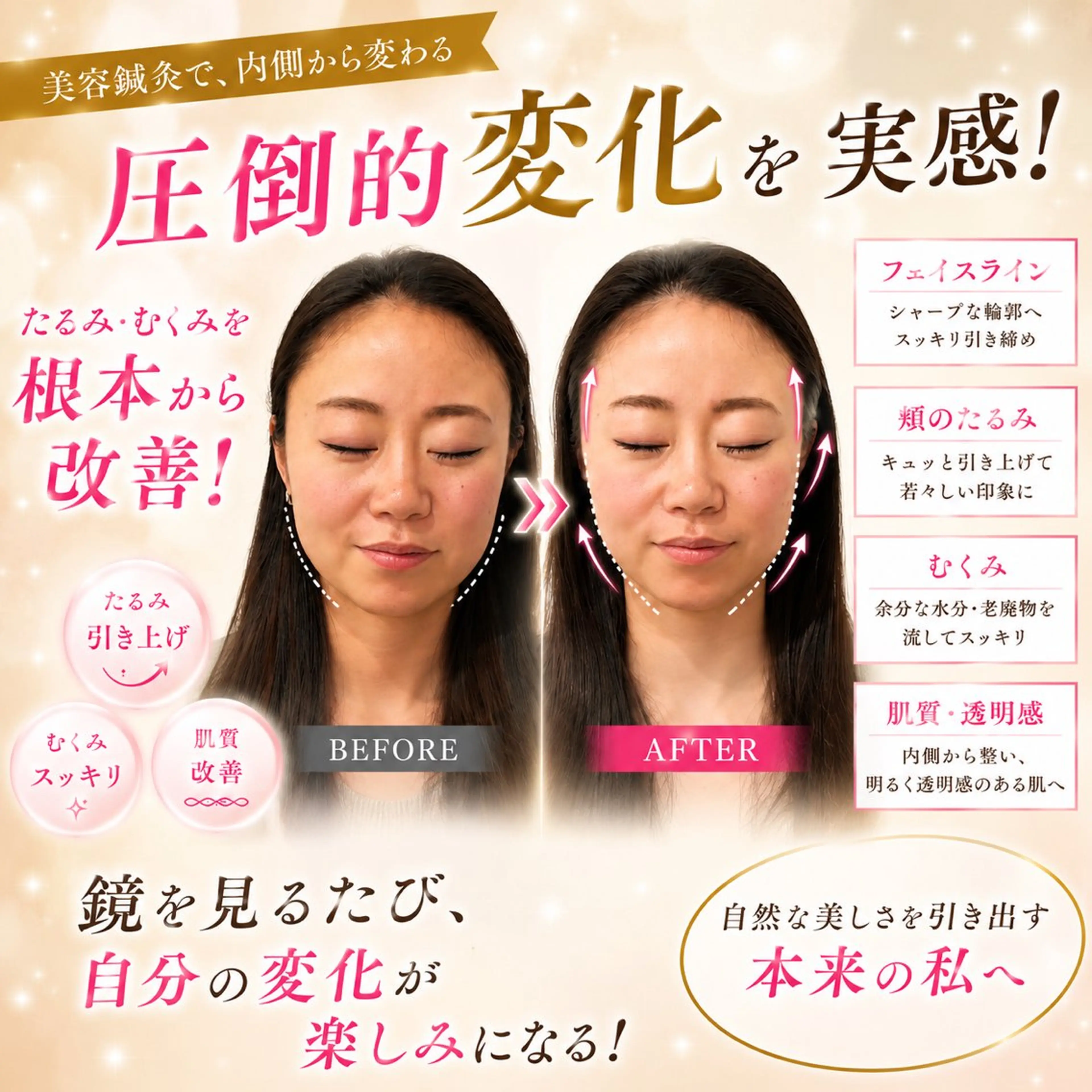 エステ リラク 肌質改善×美容鍼 ゆいのエステ・リラクイメージ
