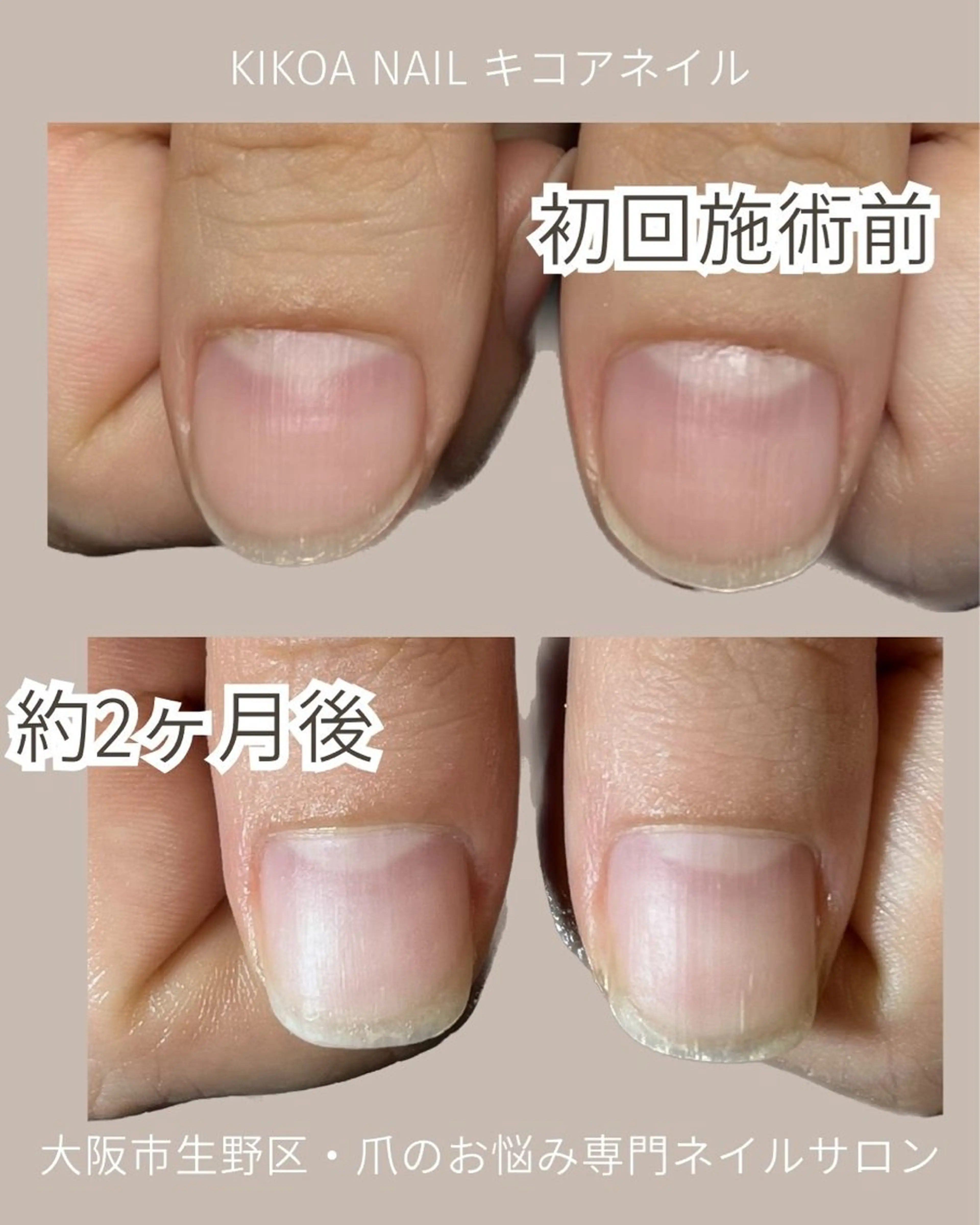 ネイル KIKOA NAIL キコアネイルのネイルデザイン