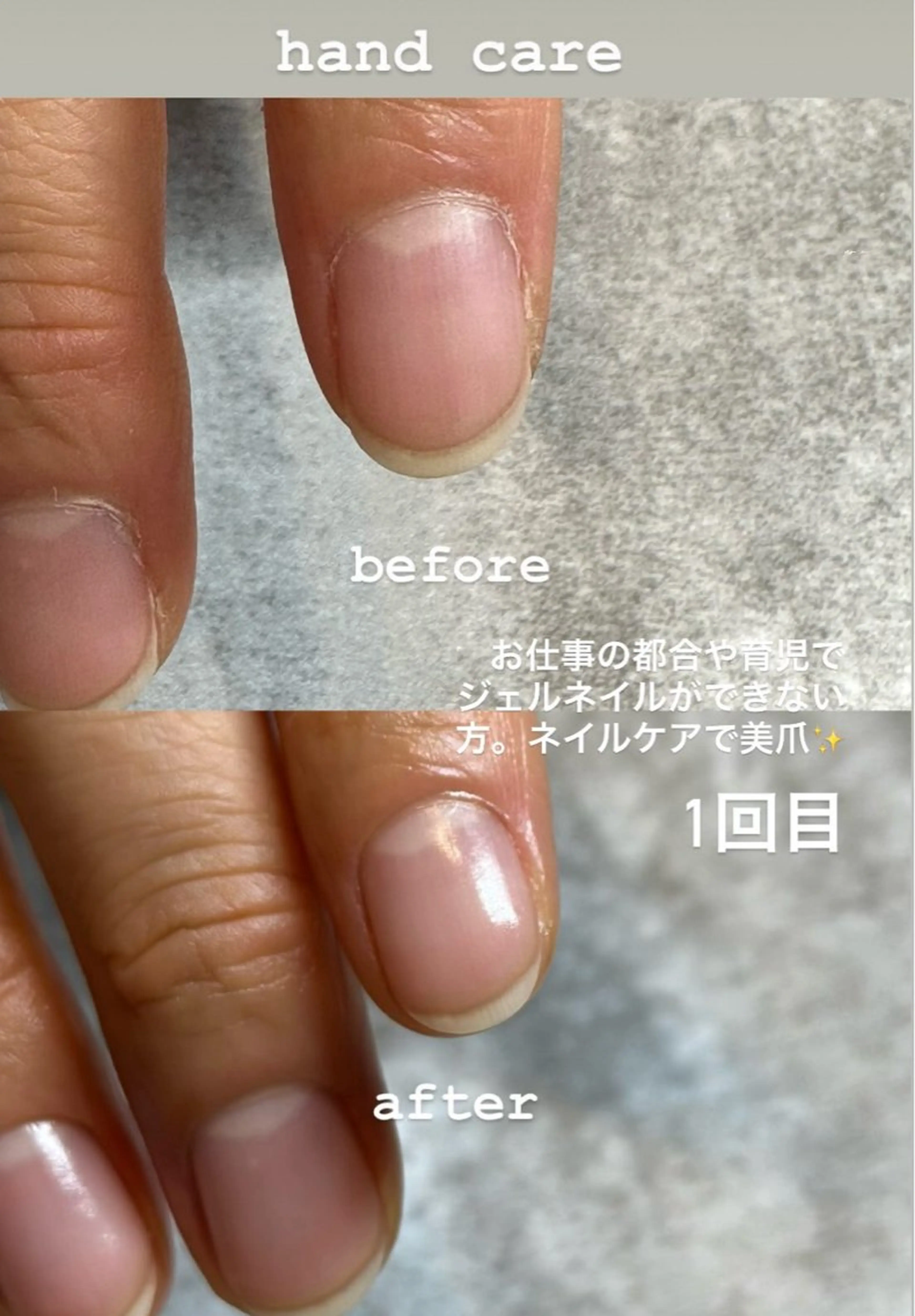 自爪美ネイルケアの写真