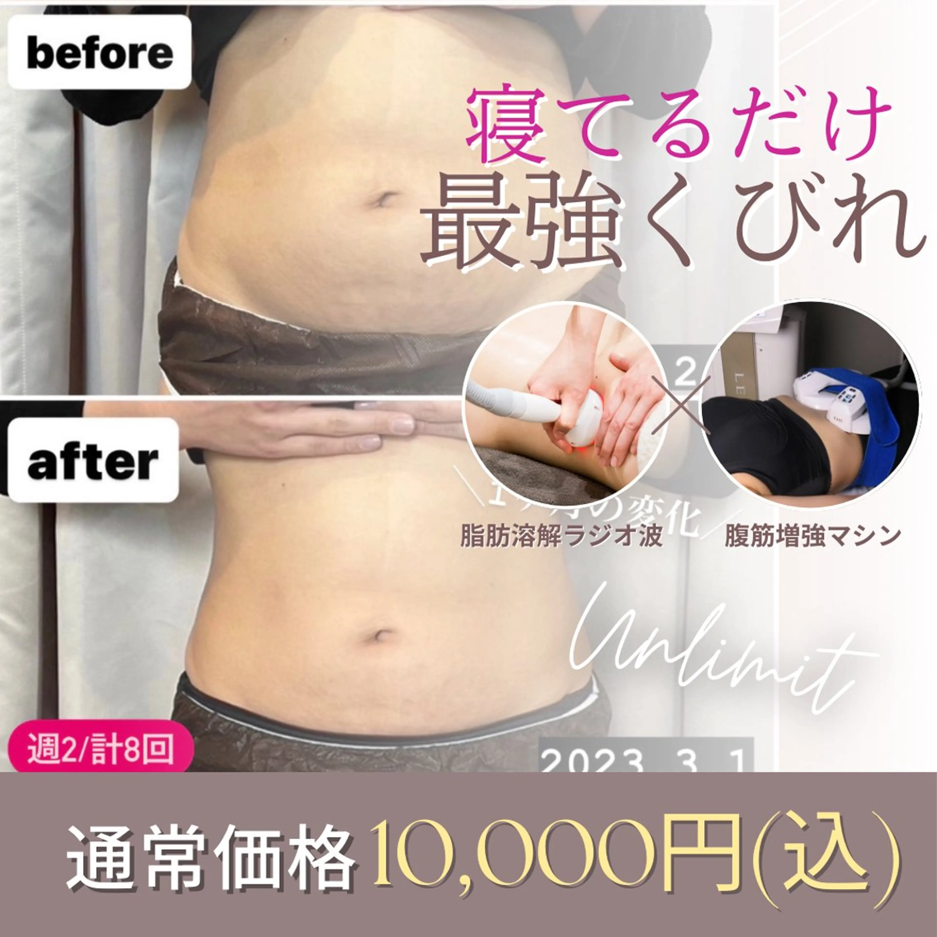 【痩身.ぽっこりお腹に◎】最強くびれ作り/ラジオ波お腹30分×腹筋増強マシン15分の写真