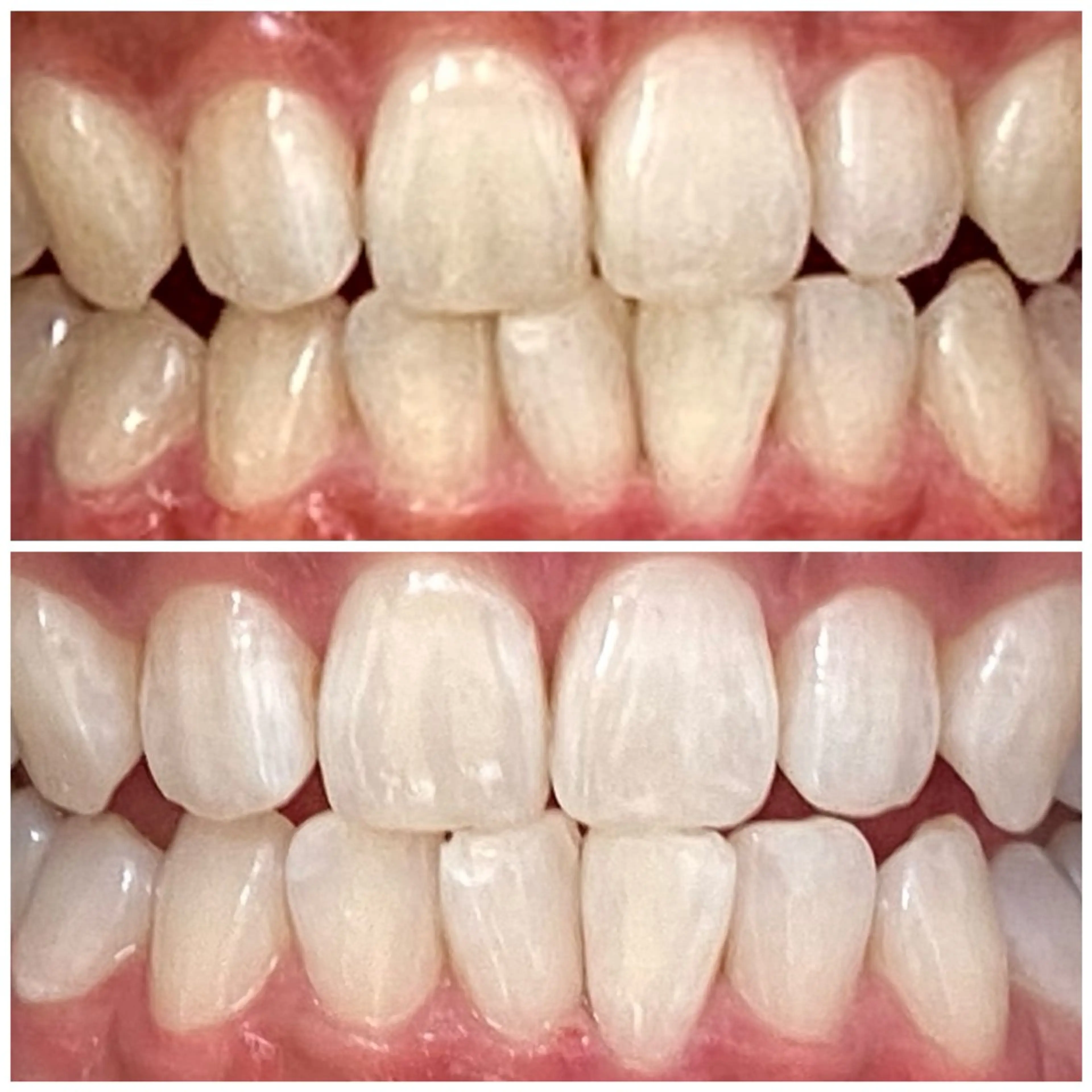 DIAMOND BEAUYのその他イメージ