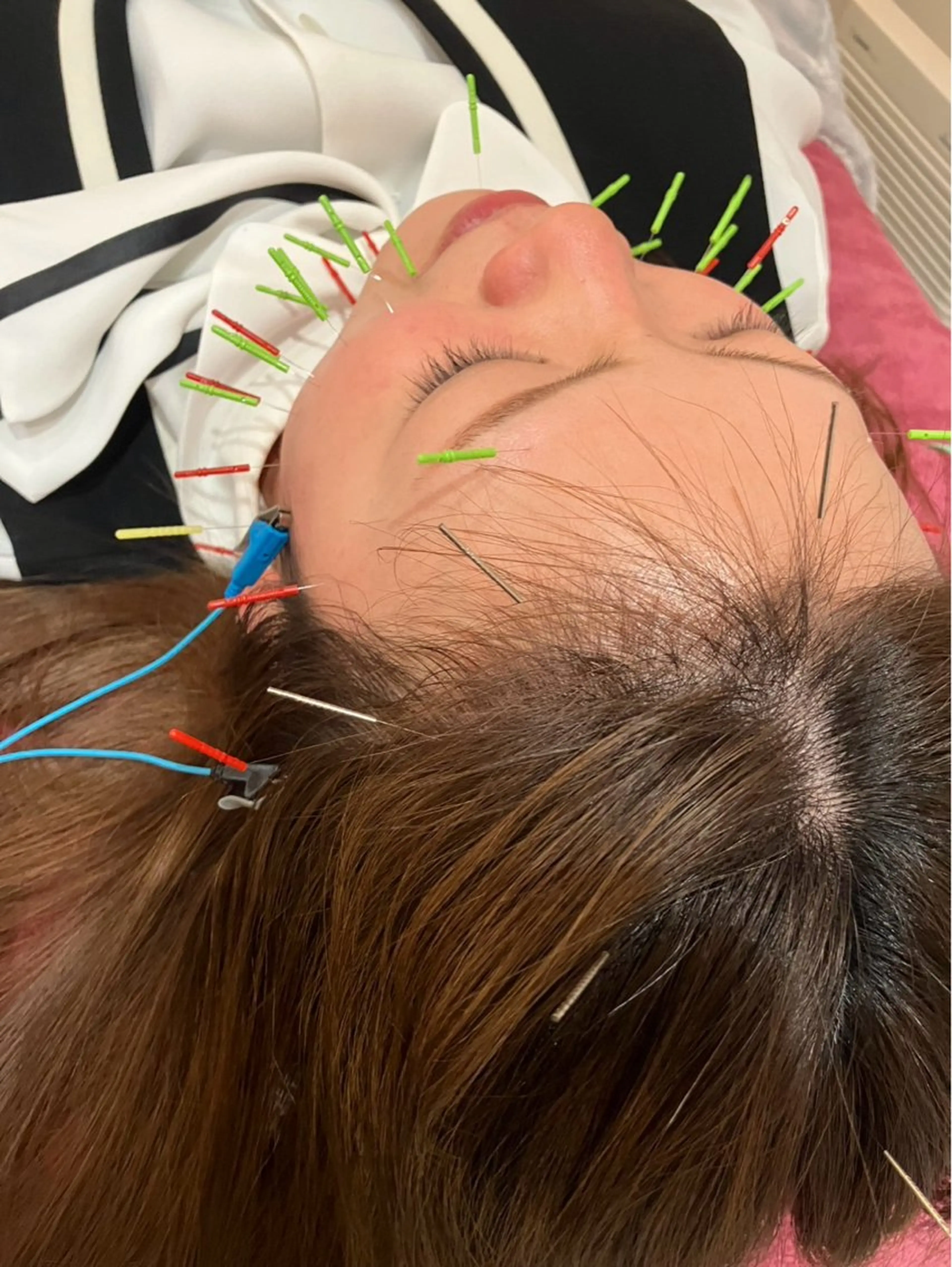 エステ リラク 美容鍼灸女性専用 りんご鍼灸治療院のその他イメージ