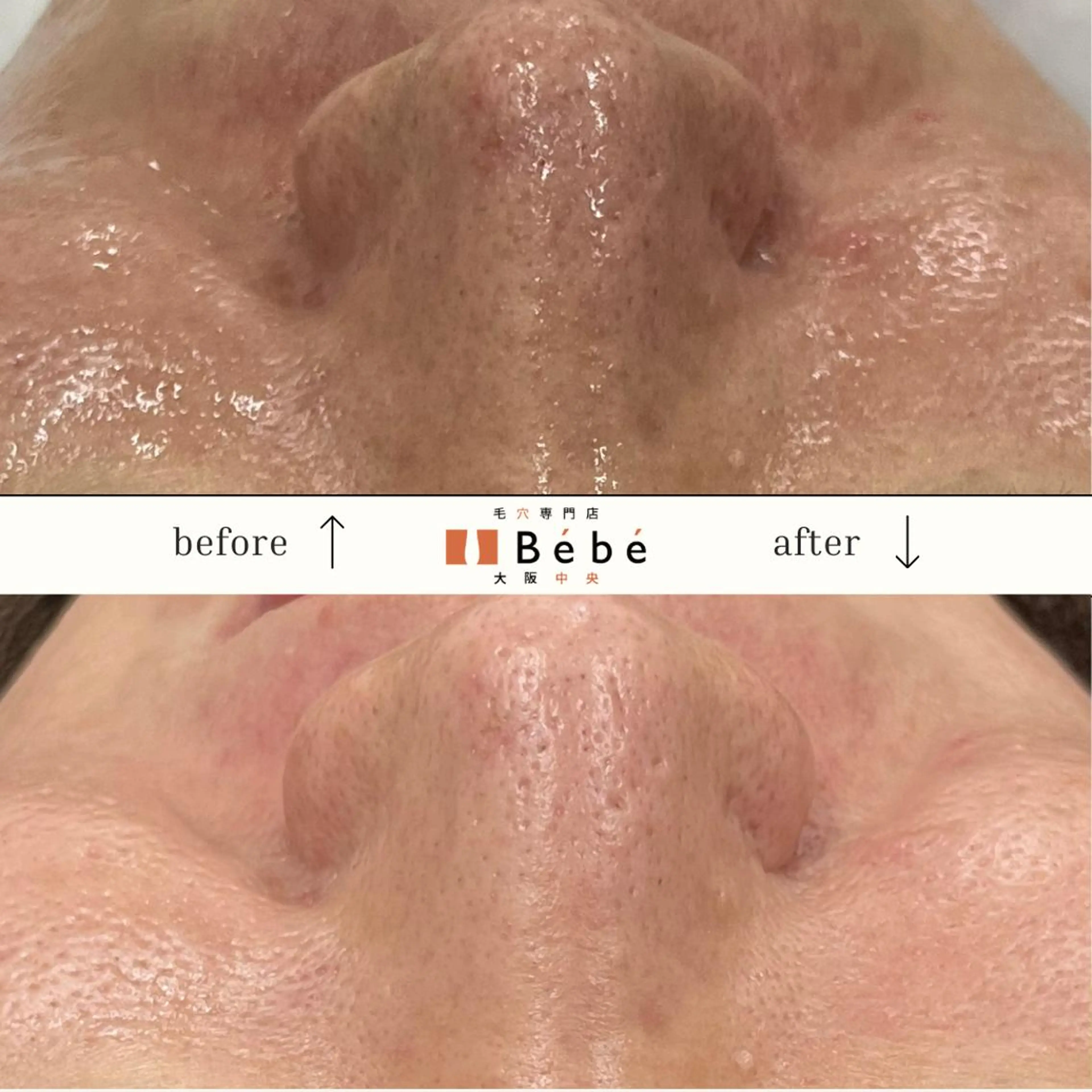 毛穴専門店Bébé 大阪中央店のエステ・リラクイメージ
