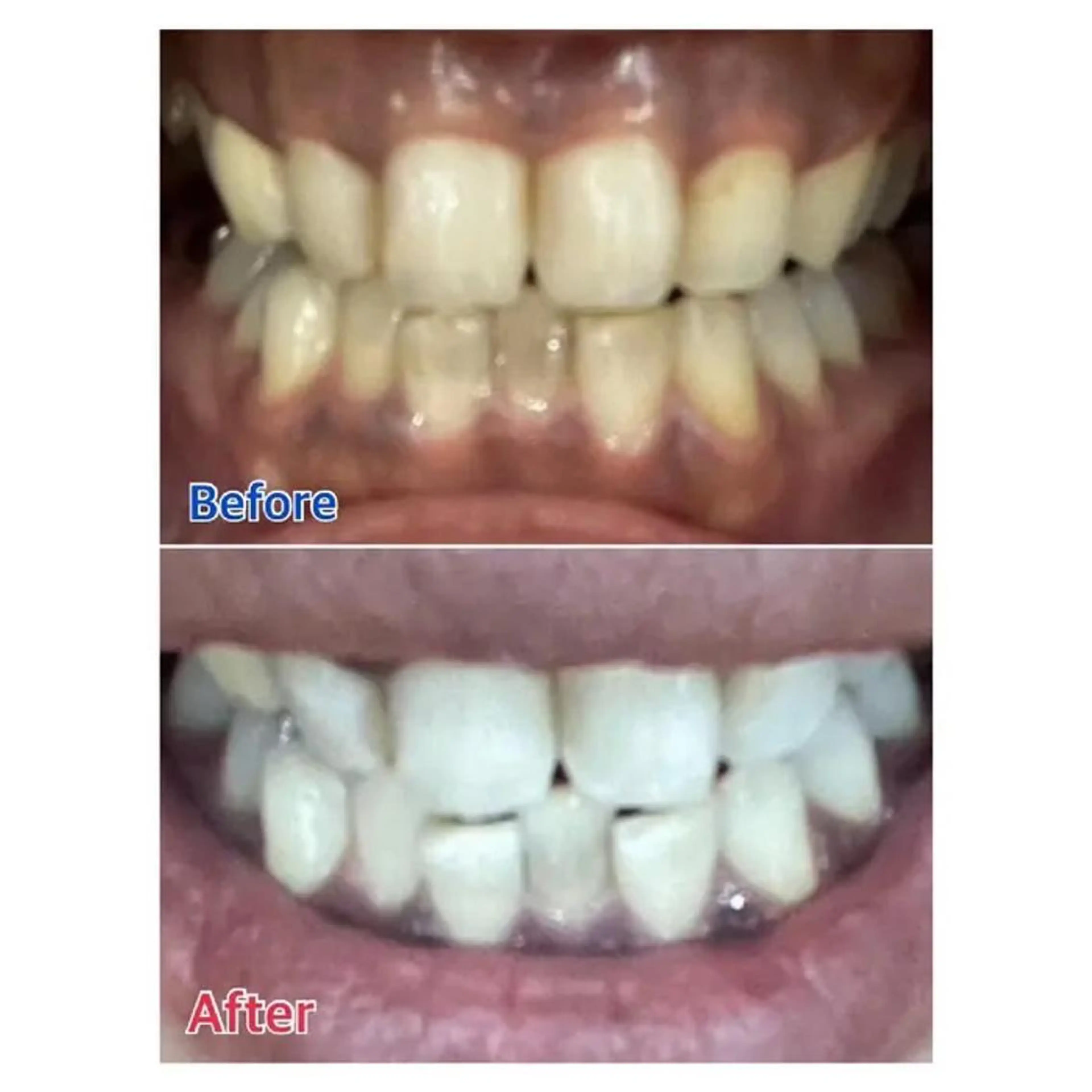 M渋谷 ホワイトニングのその他イメージ