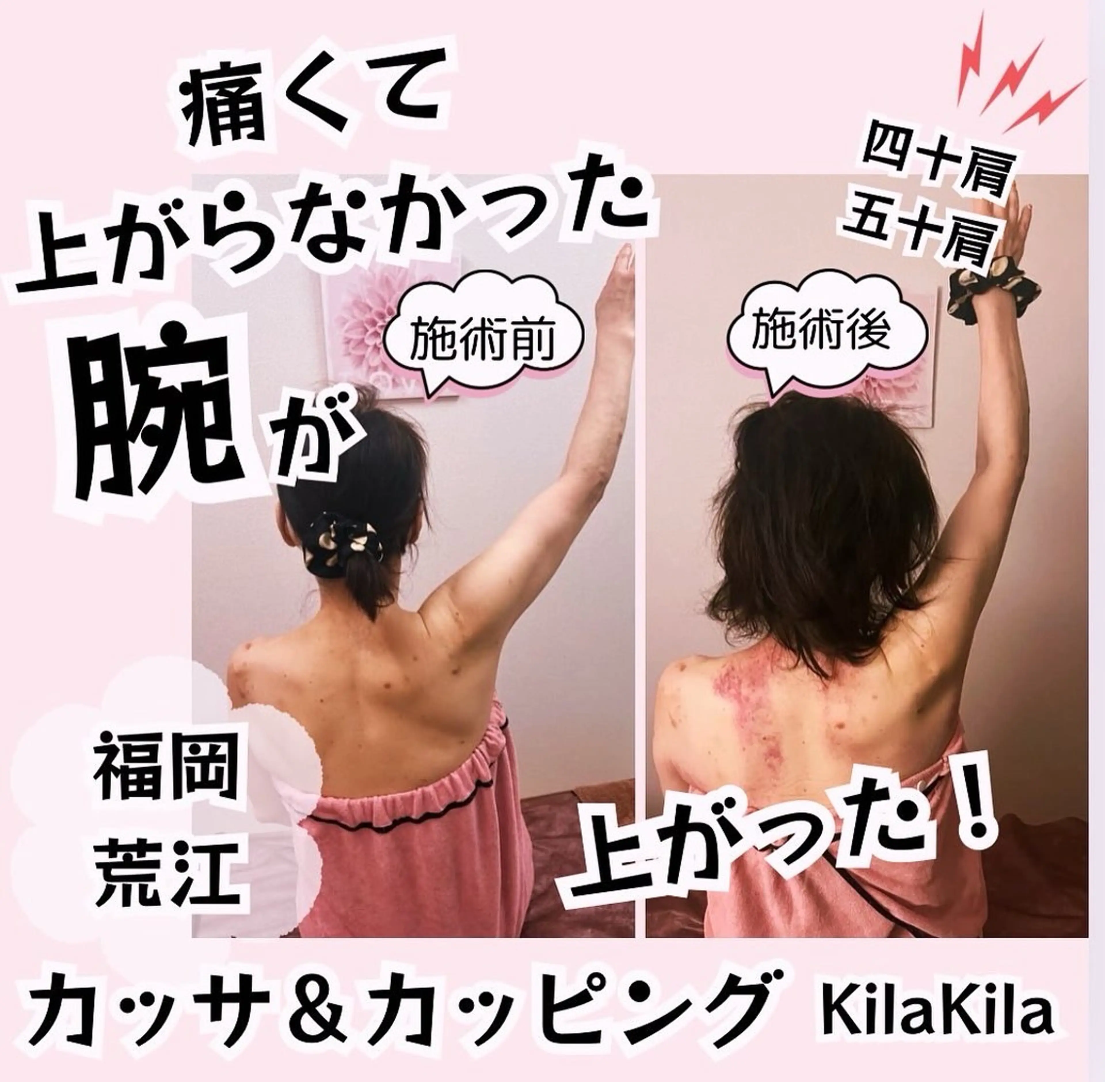 ドライヘッドスパ KilaKilaのエステ・リラクイメージ