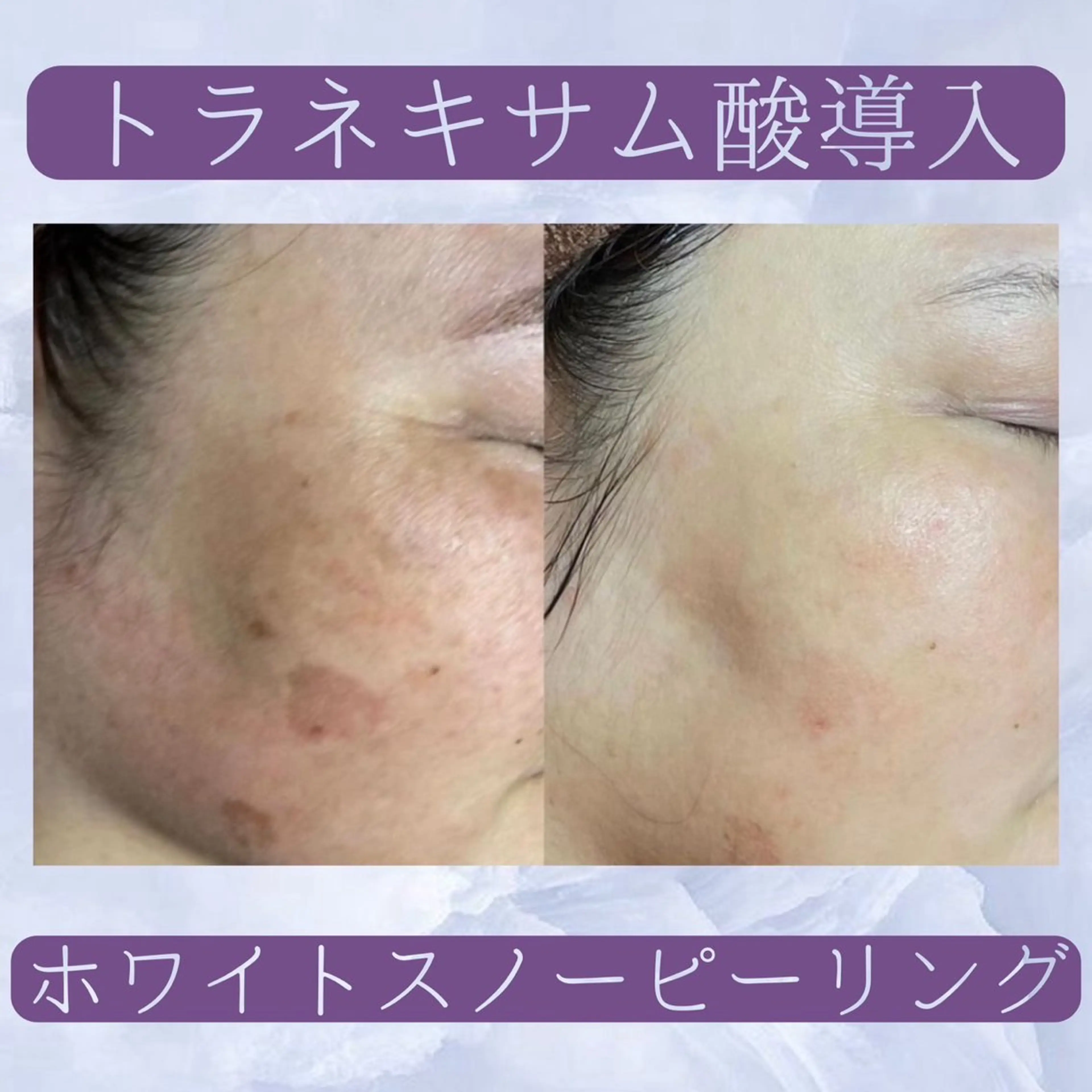 ココルアナ橋本店所属・ココルアナ 橋本店のエステ・リラクイメージ