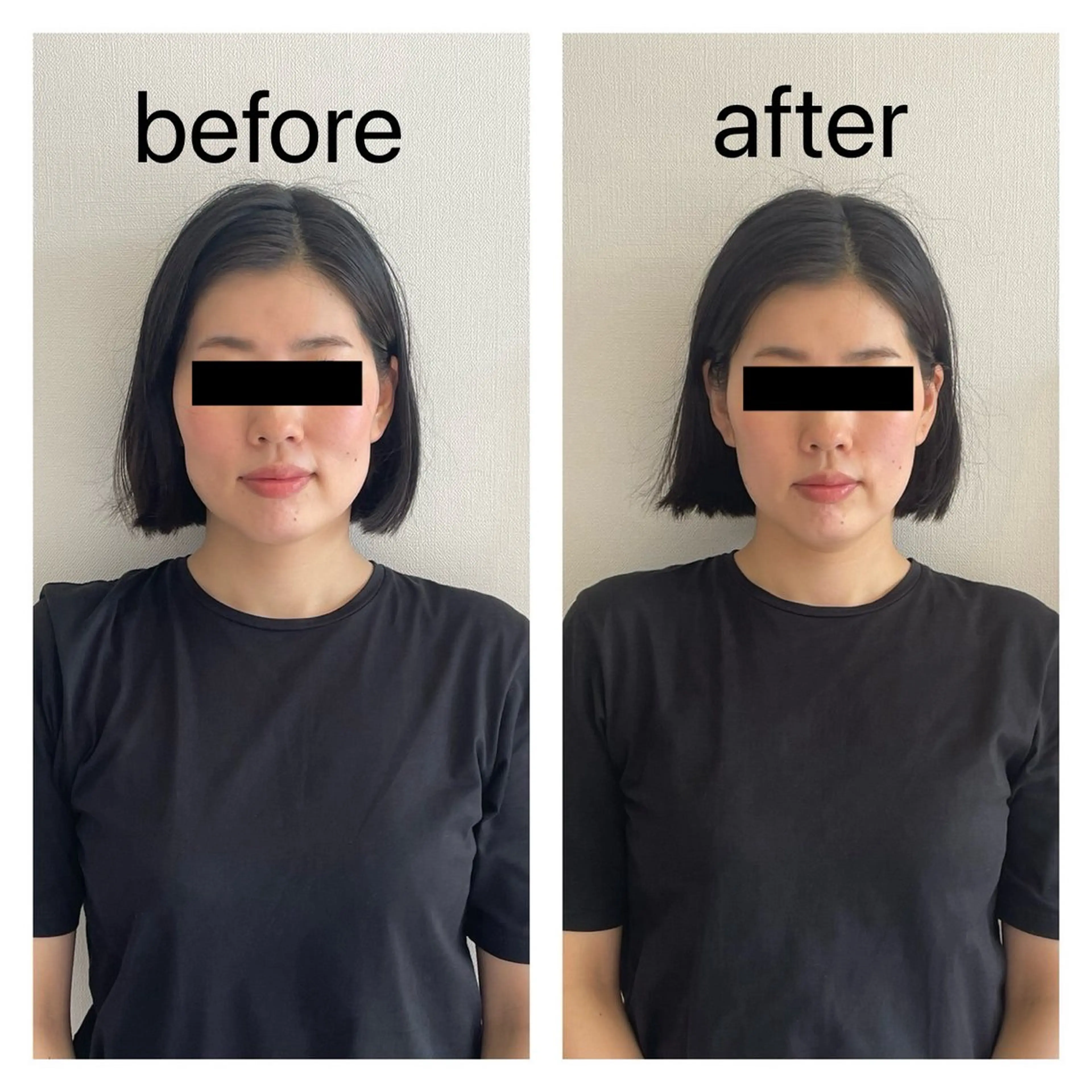 エステ リラク 小顔矯正・美容鍼 FLOW鍼灸整体院のエステ・リラクイメージ