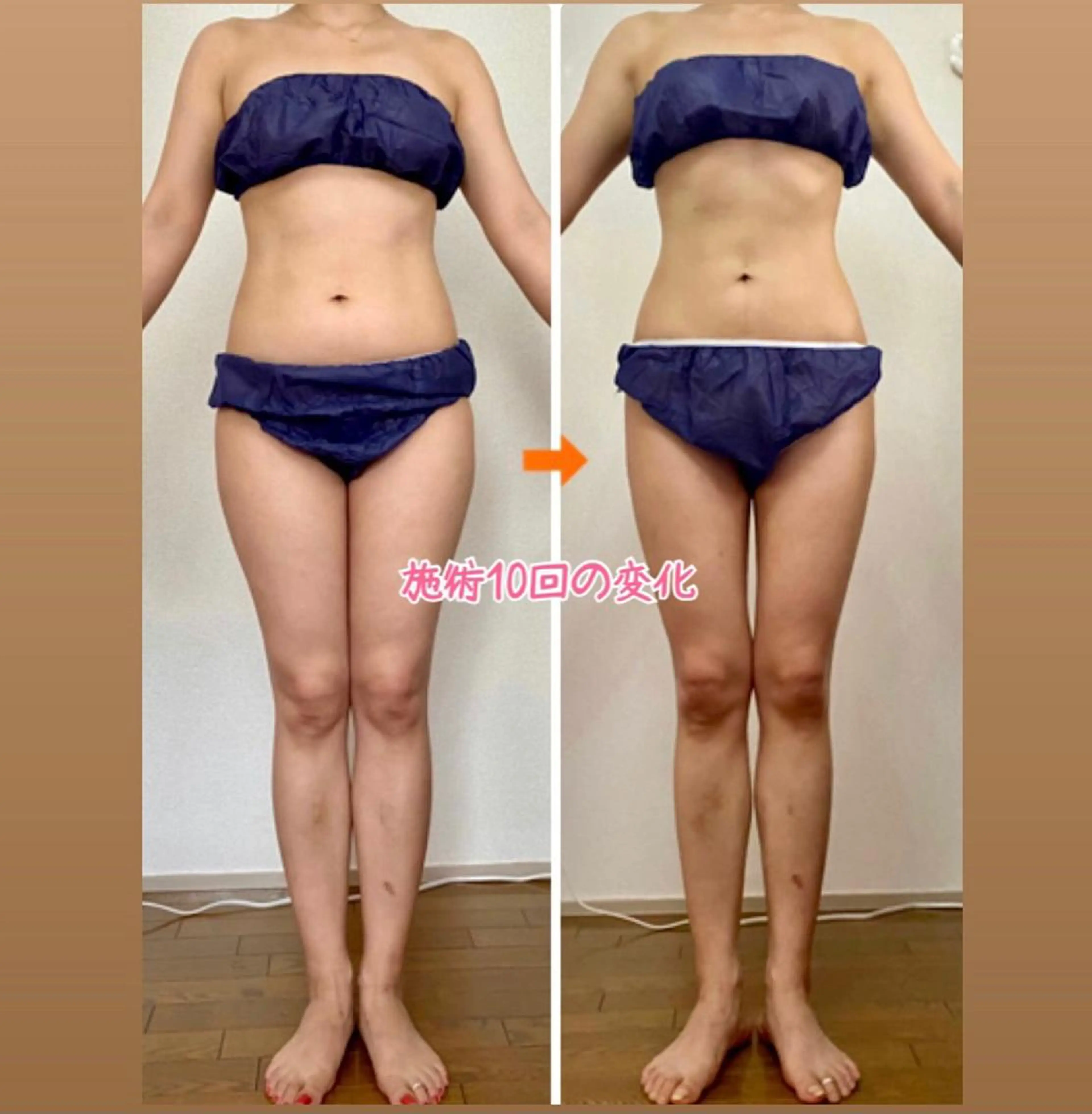 ショート カラー パーマ ヘアアレンジ メンズ キッズ ネイル マツエク・マツパ エステ リラク 痩身&ボディ 結果出し🌟丹野のエステ・リラクイメージ