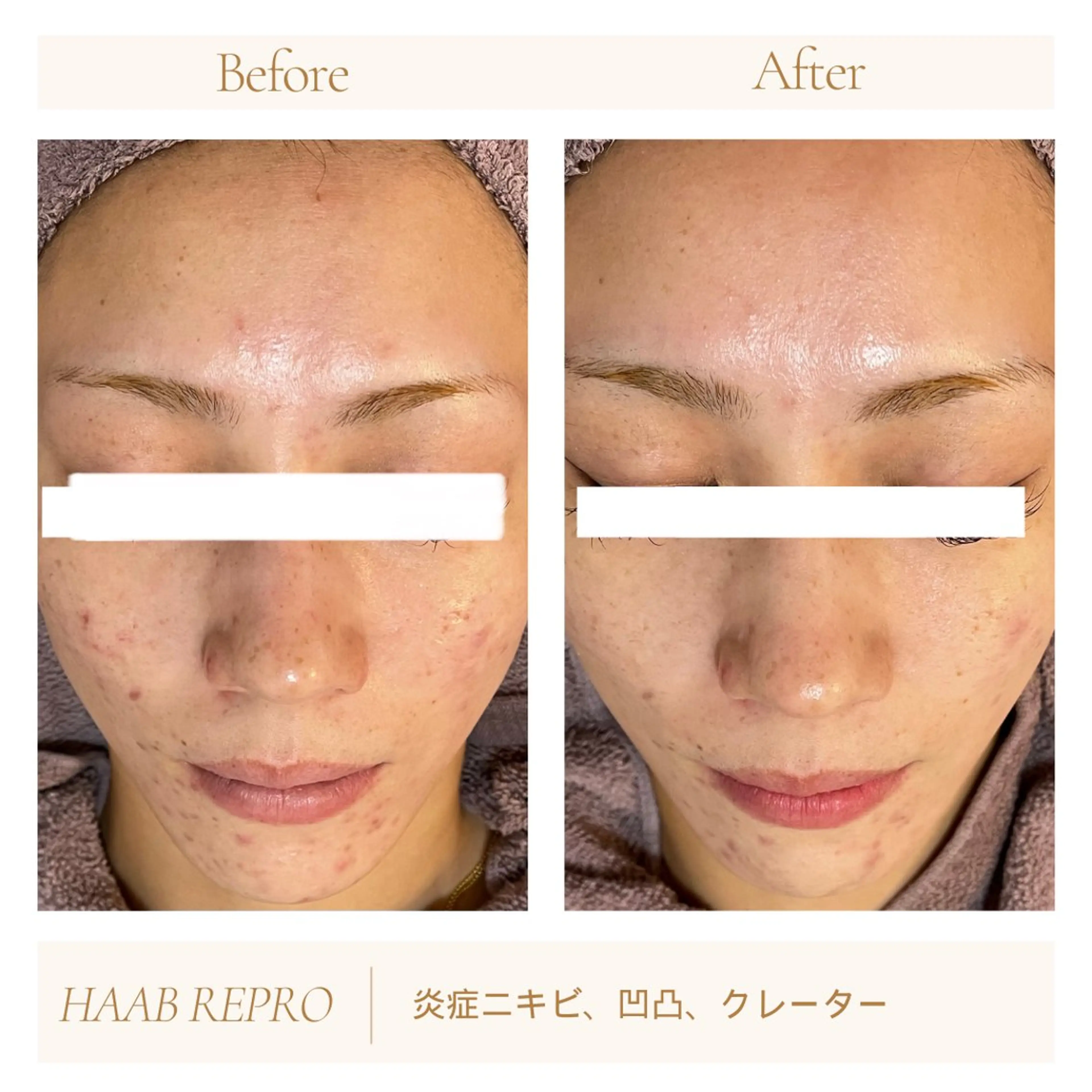 1ヶ月後も半分残る 高持続LEDエクステのマツエク・マツパデザイン