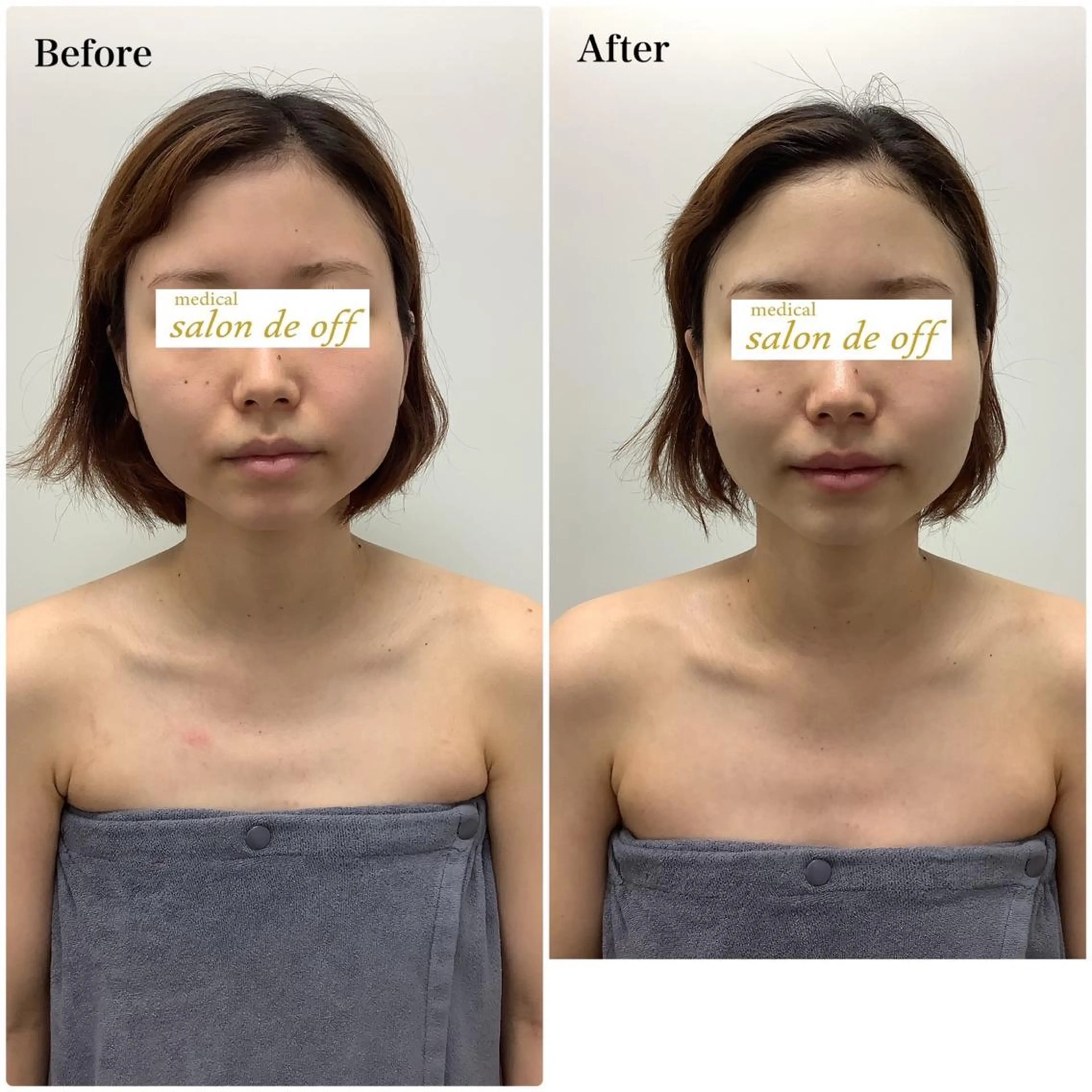 ハリサロンドオフ 美容鍼灸×小顔整体のエステ・リラクイメージ