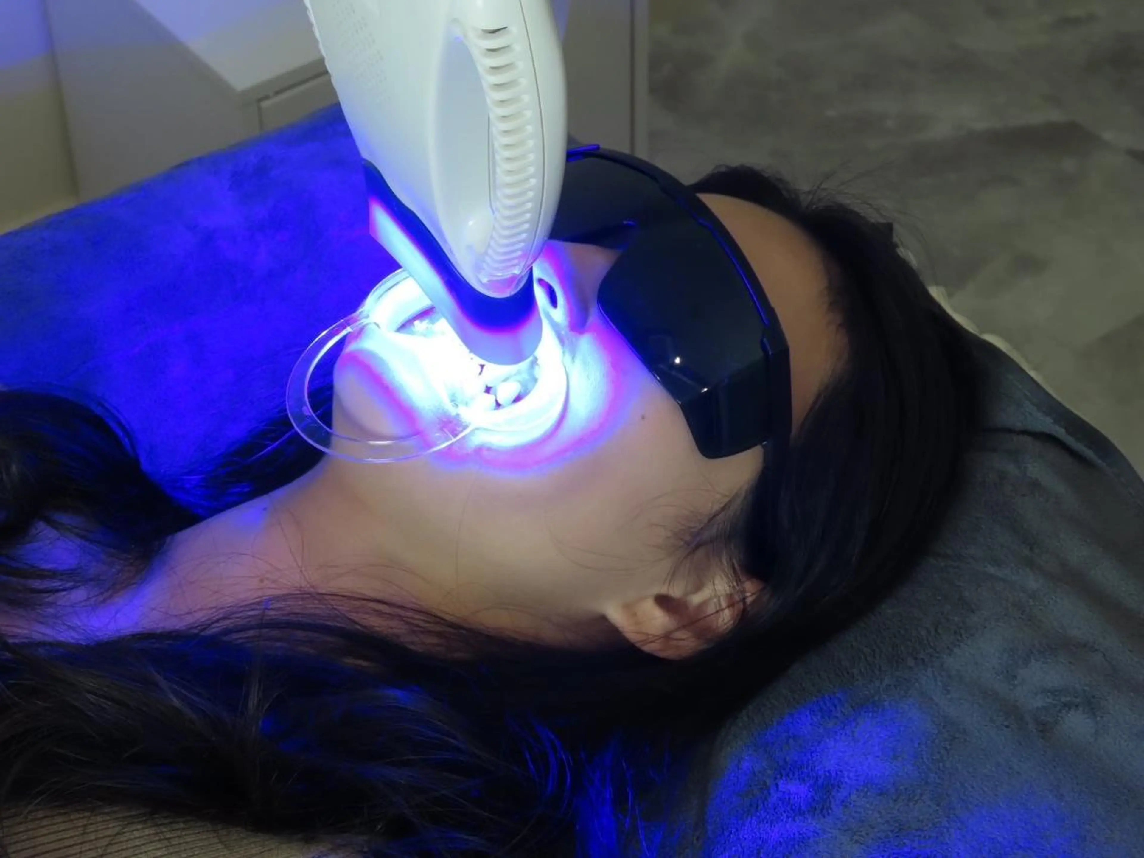 【ミニモ限定】セルフホワイトニング🦷8分×2回 🩷女性も男性も歓迎🩷の写真