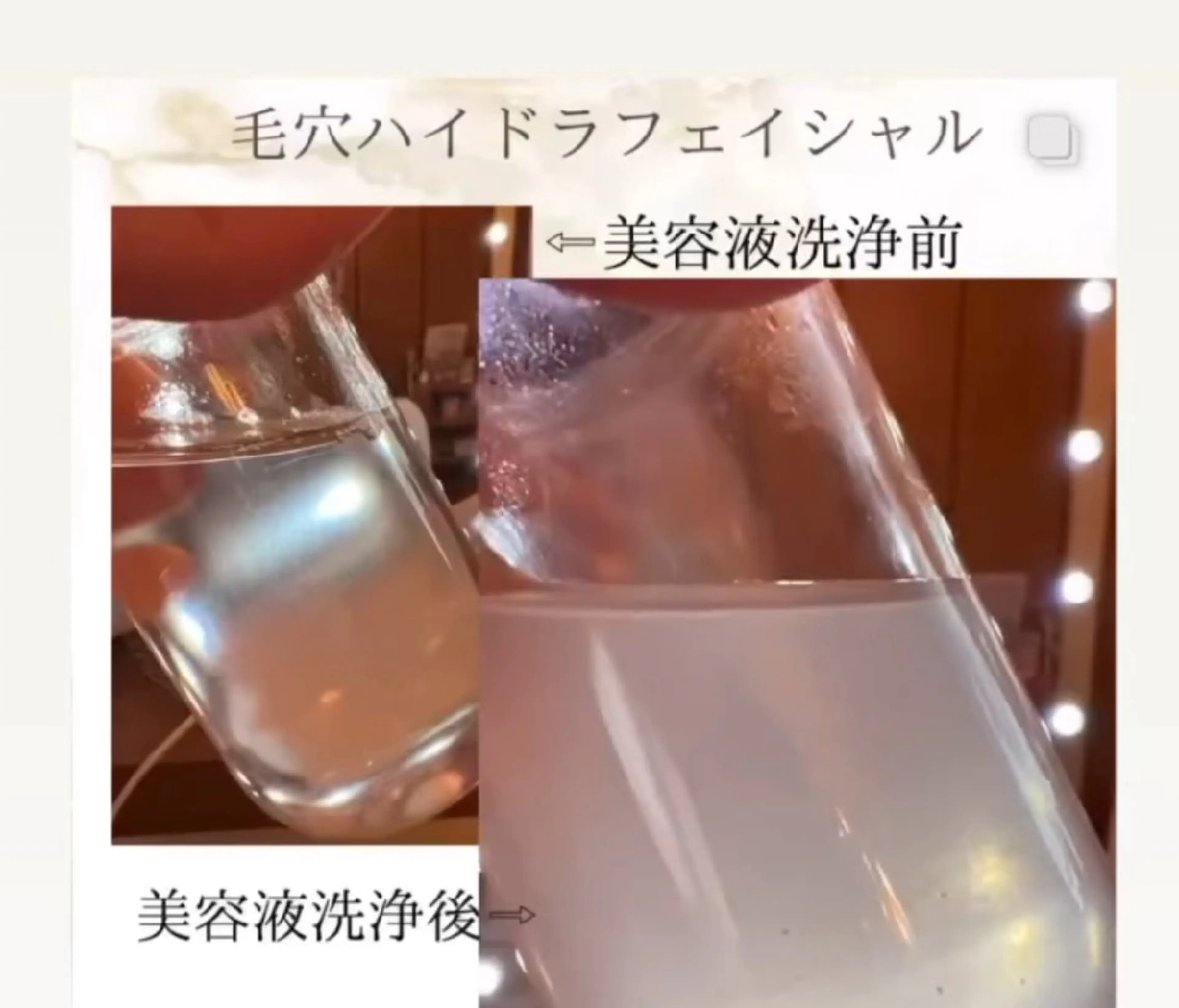 肌質改善BIOELプ ラズマ/ラミピールのエステ・リラクイメージ