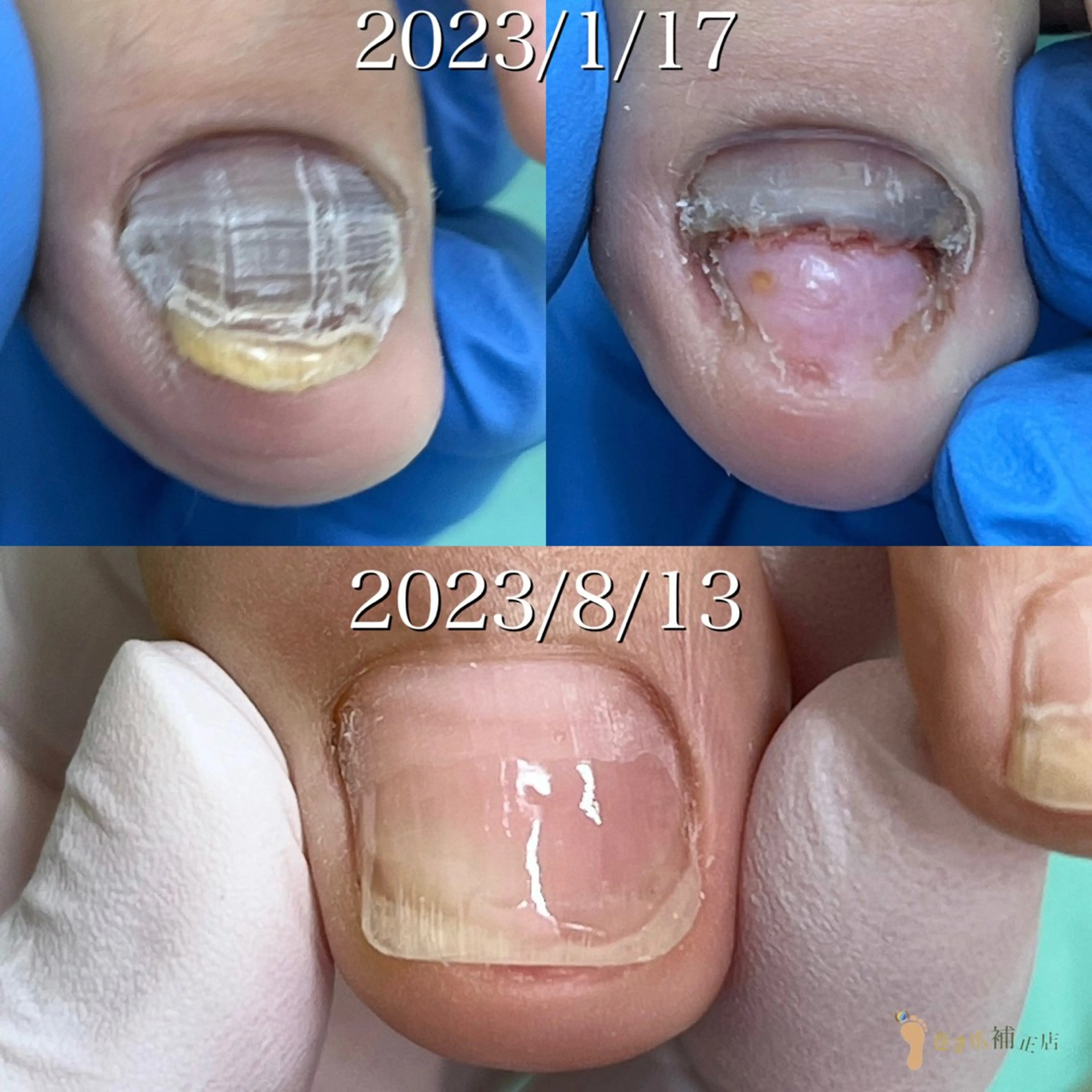 東京巻き爪 アカデミーのエステ・リラクイメージ