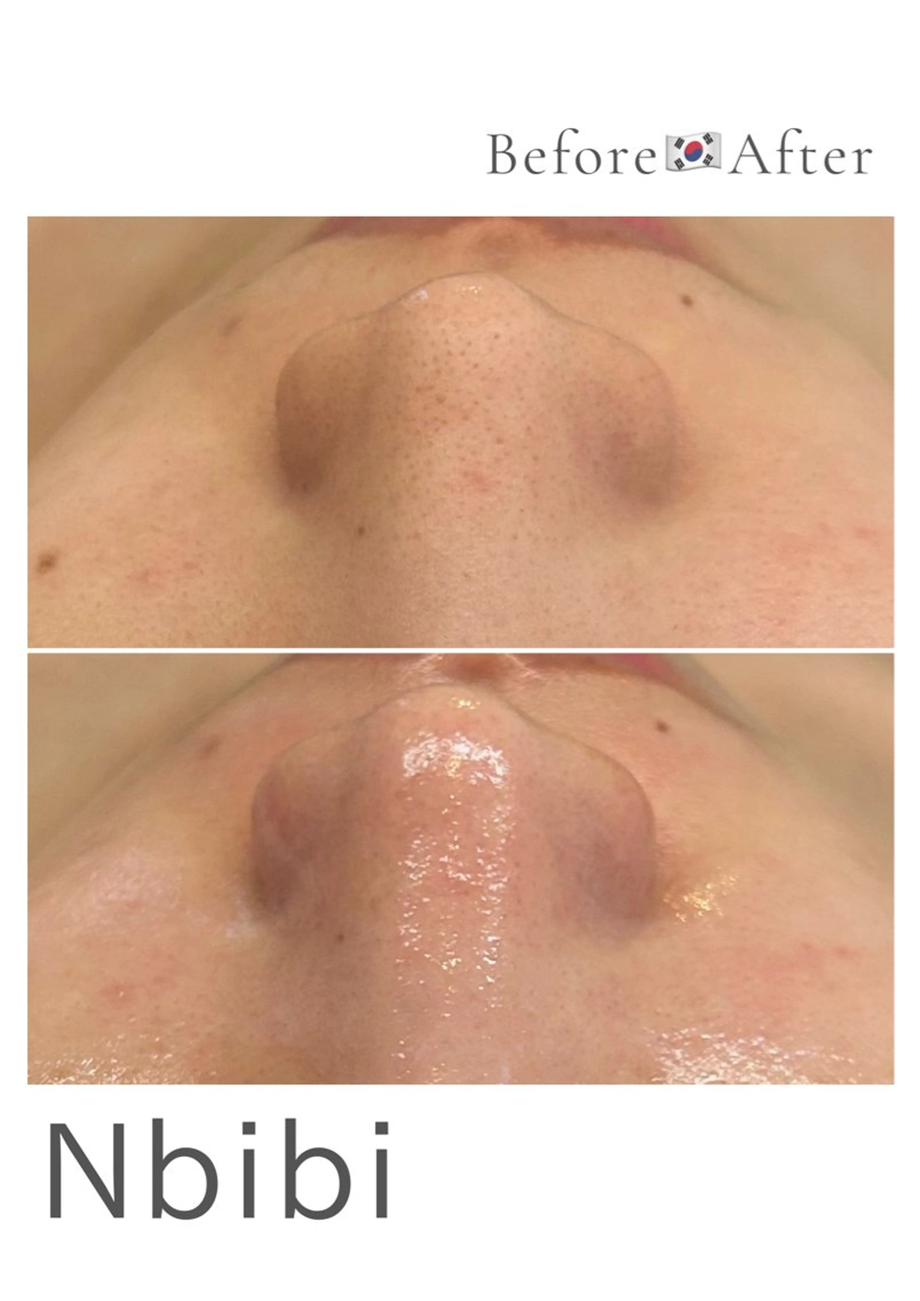 エステ 韓国🇰🇷価格 サロン_Nbibiの眉毛・アイブロウイメージ