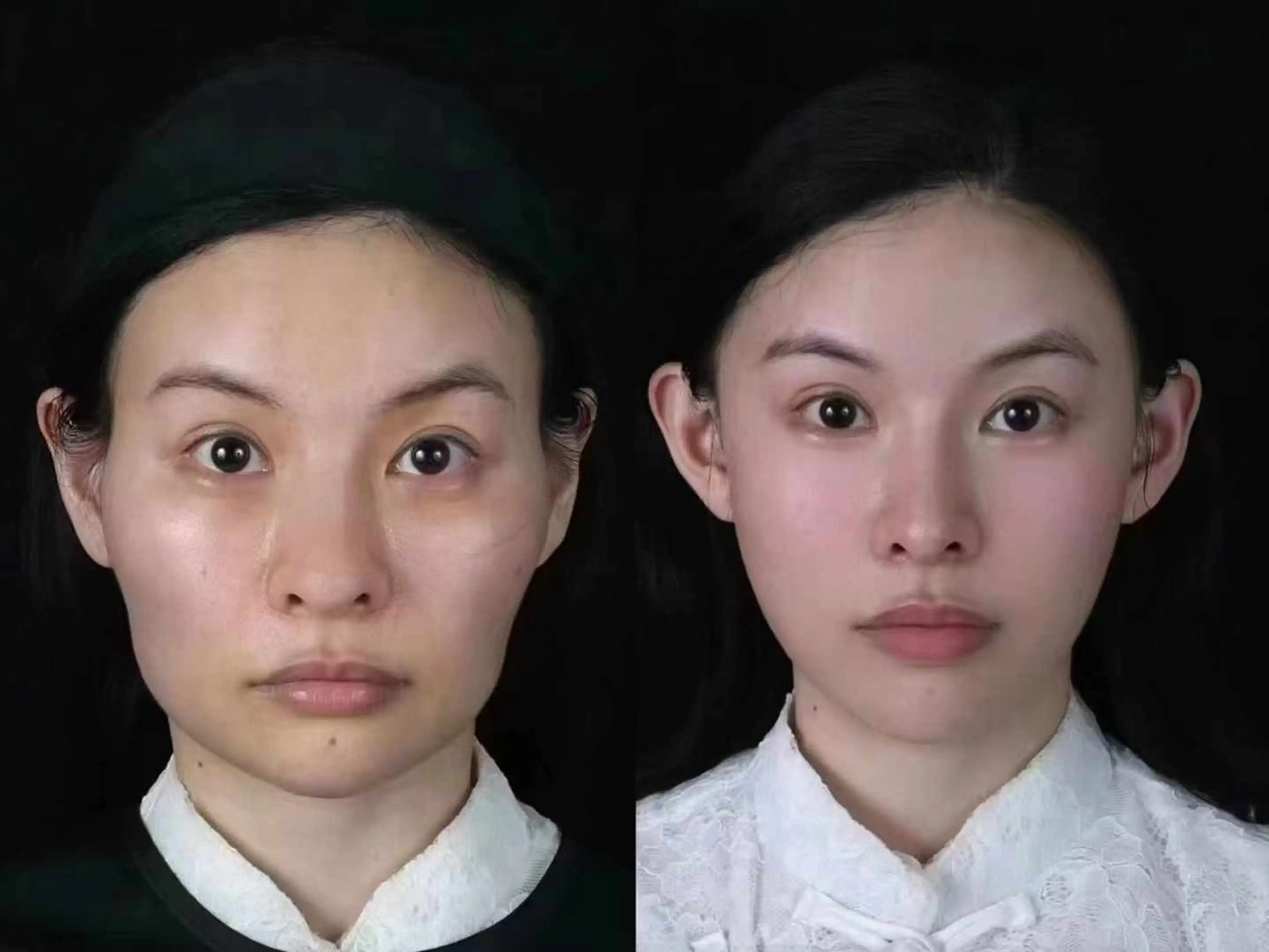 ネイル エステ aliaハイフ&水光ジェットサロン所属・aliaハーブ水光店 エステティシャン募集のエステ・リラクイメージ