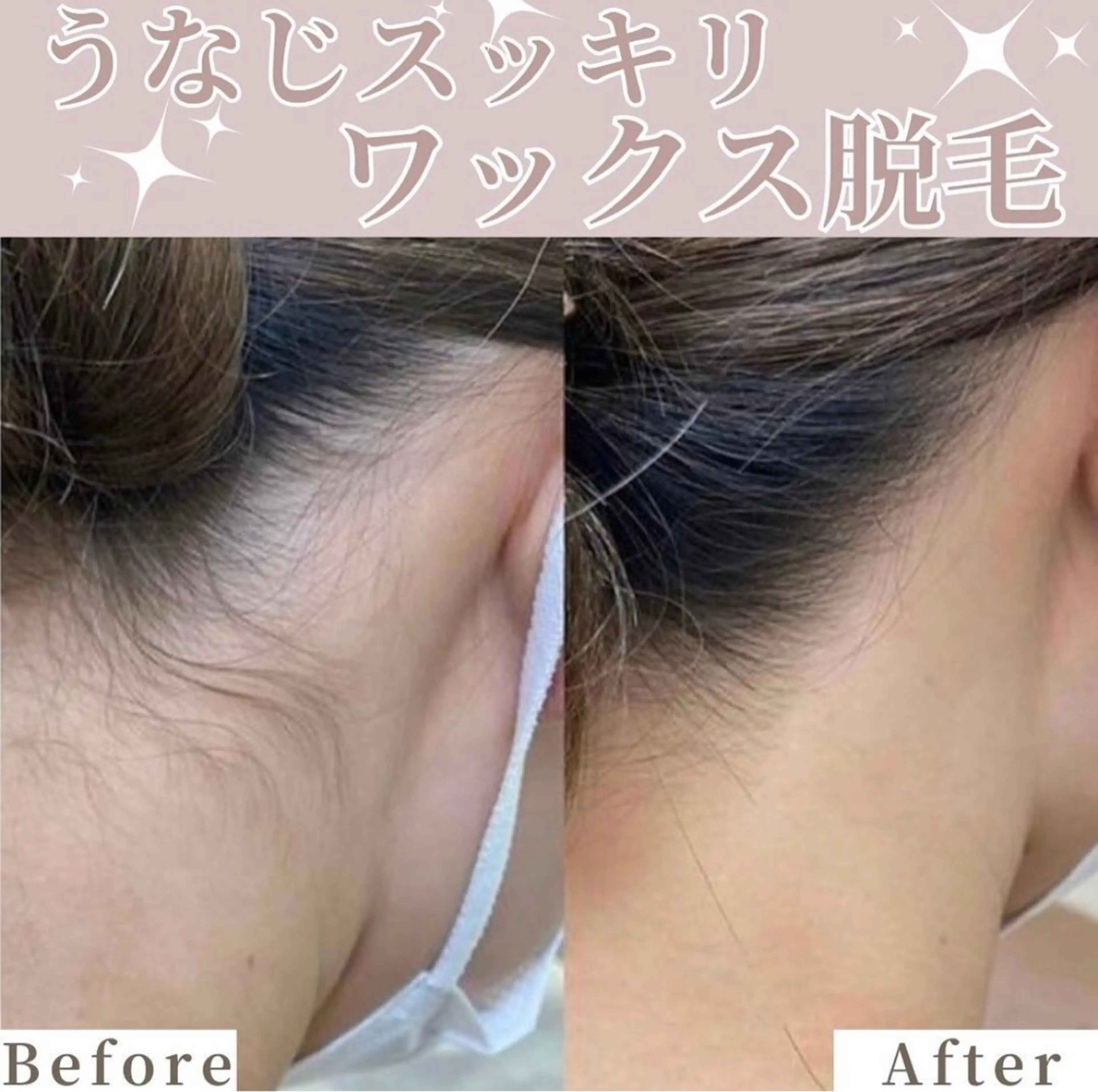 脱毛サロンALGO所属・美肌脱毛/ワックス ALGO高槻店のエステ・リラクイメージ