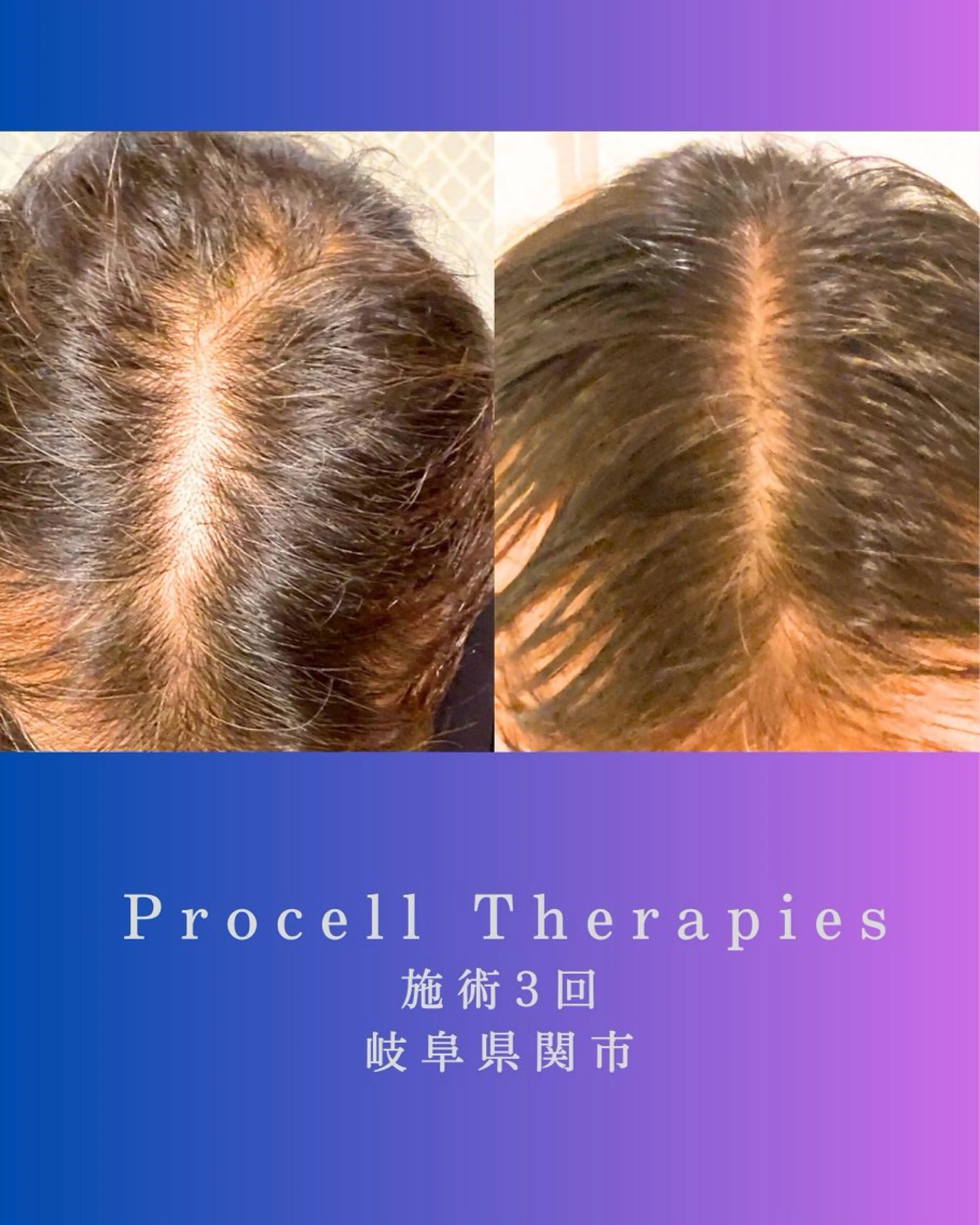 その他 氣楽所属・松下 さゆりのエステ・リラクイメージ