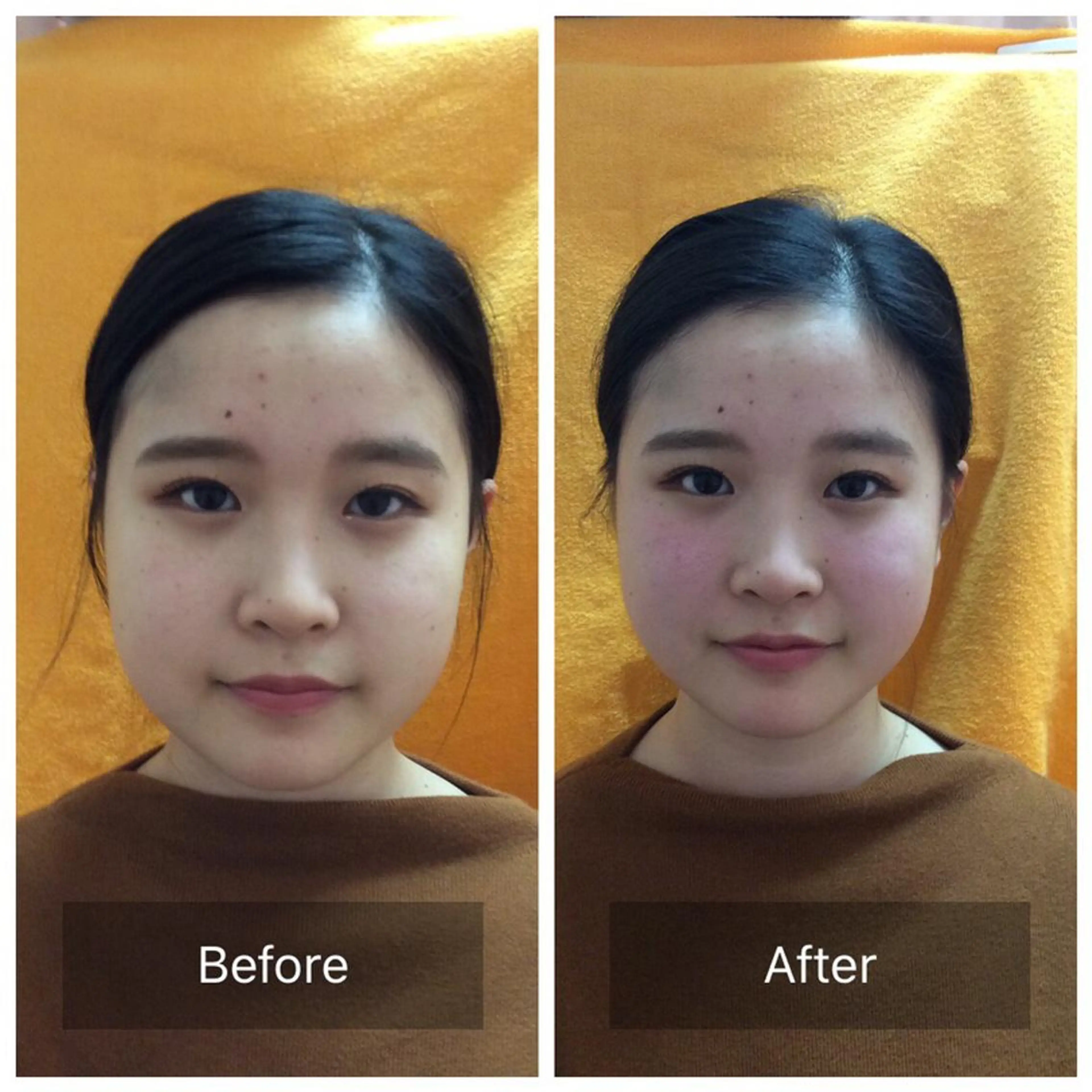 美容鍼×小顔矯正× 美容整体/小林幸司のエステ・リラクイメージ