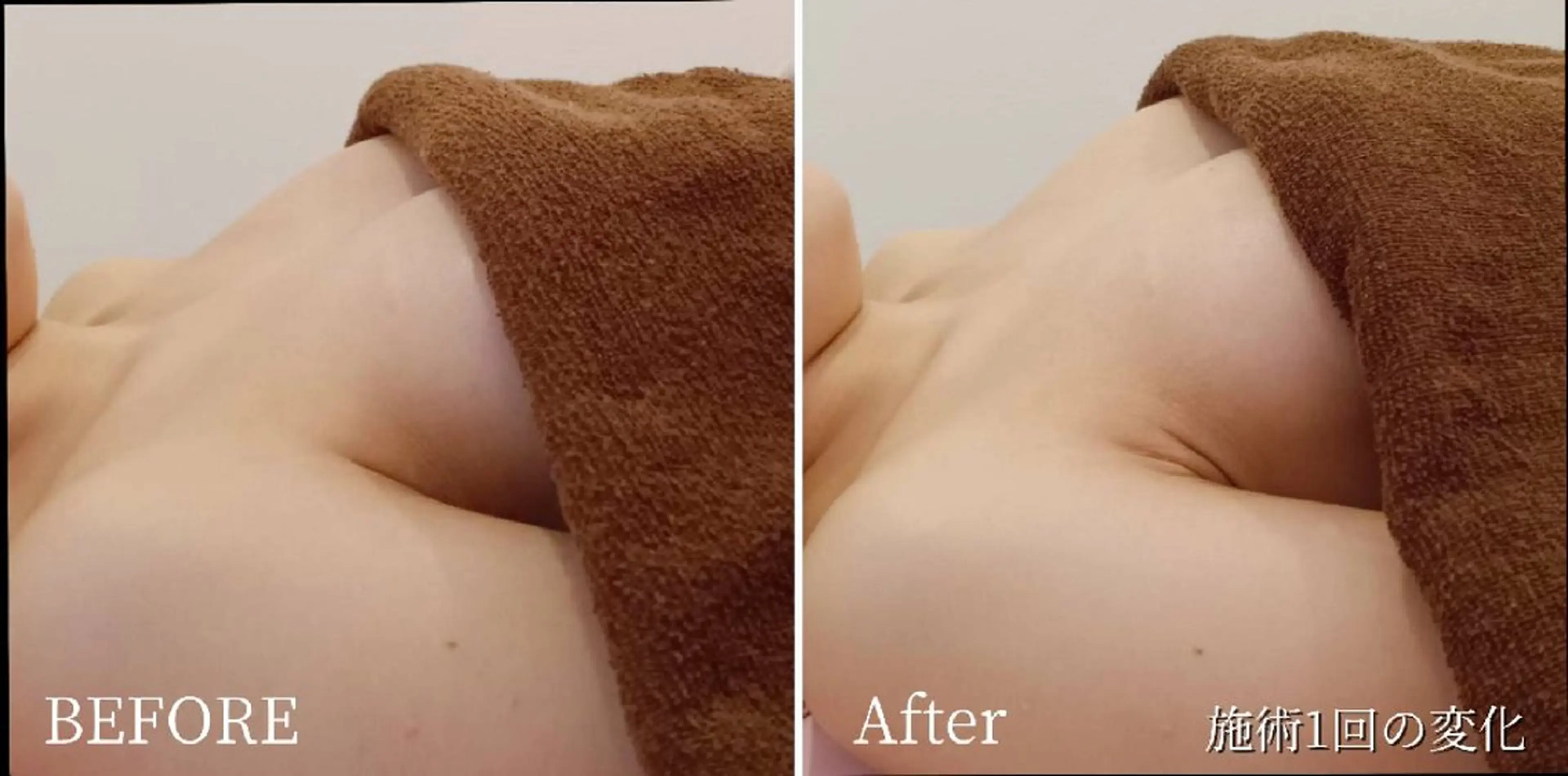 エステ マシュマロバスト coucouのエステ・リラクイメージ