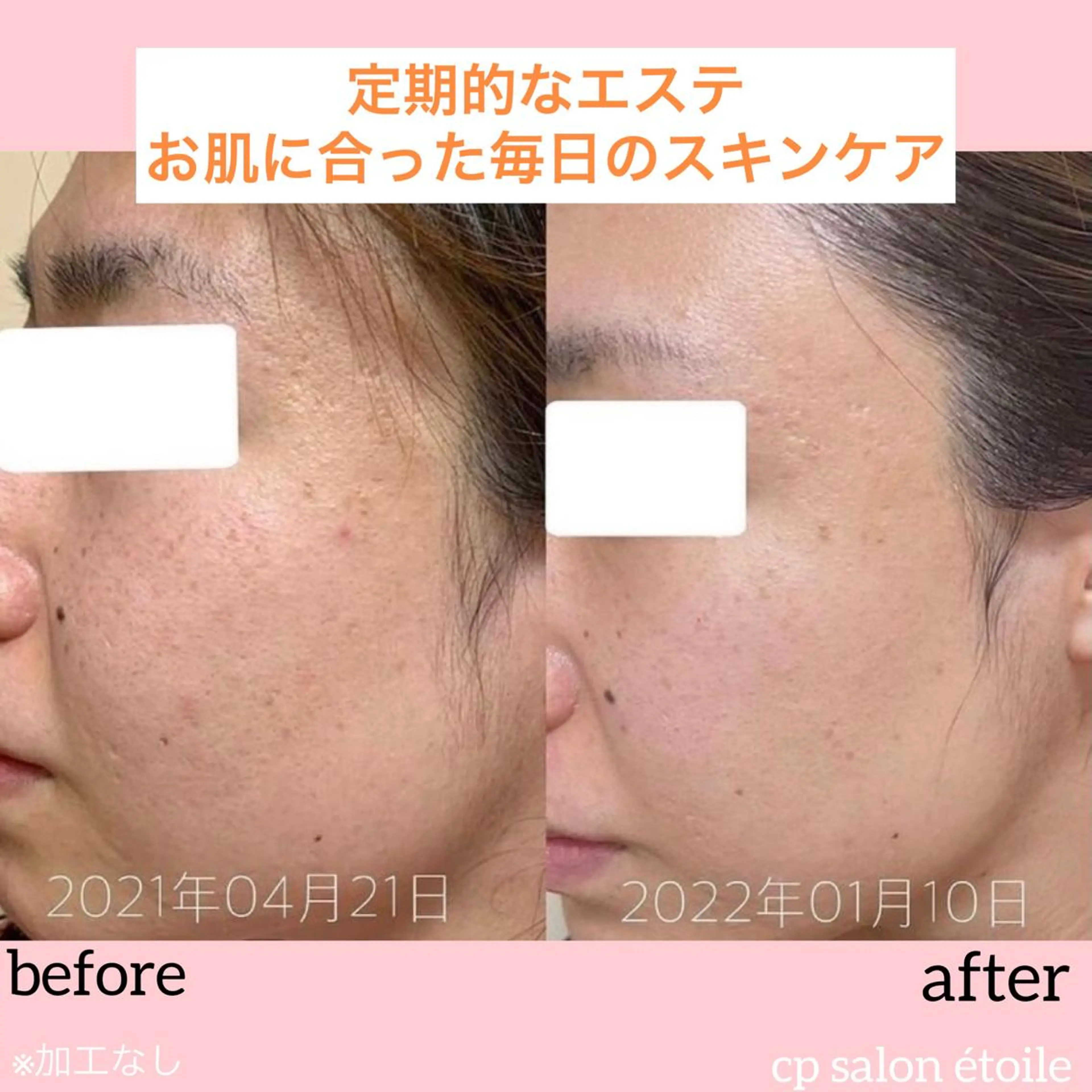 pansy(パンジー)上野フェイシャルエステ専門店所属・pansy フェイシャルエステのエステ・リラクイメージ