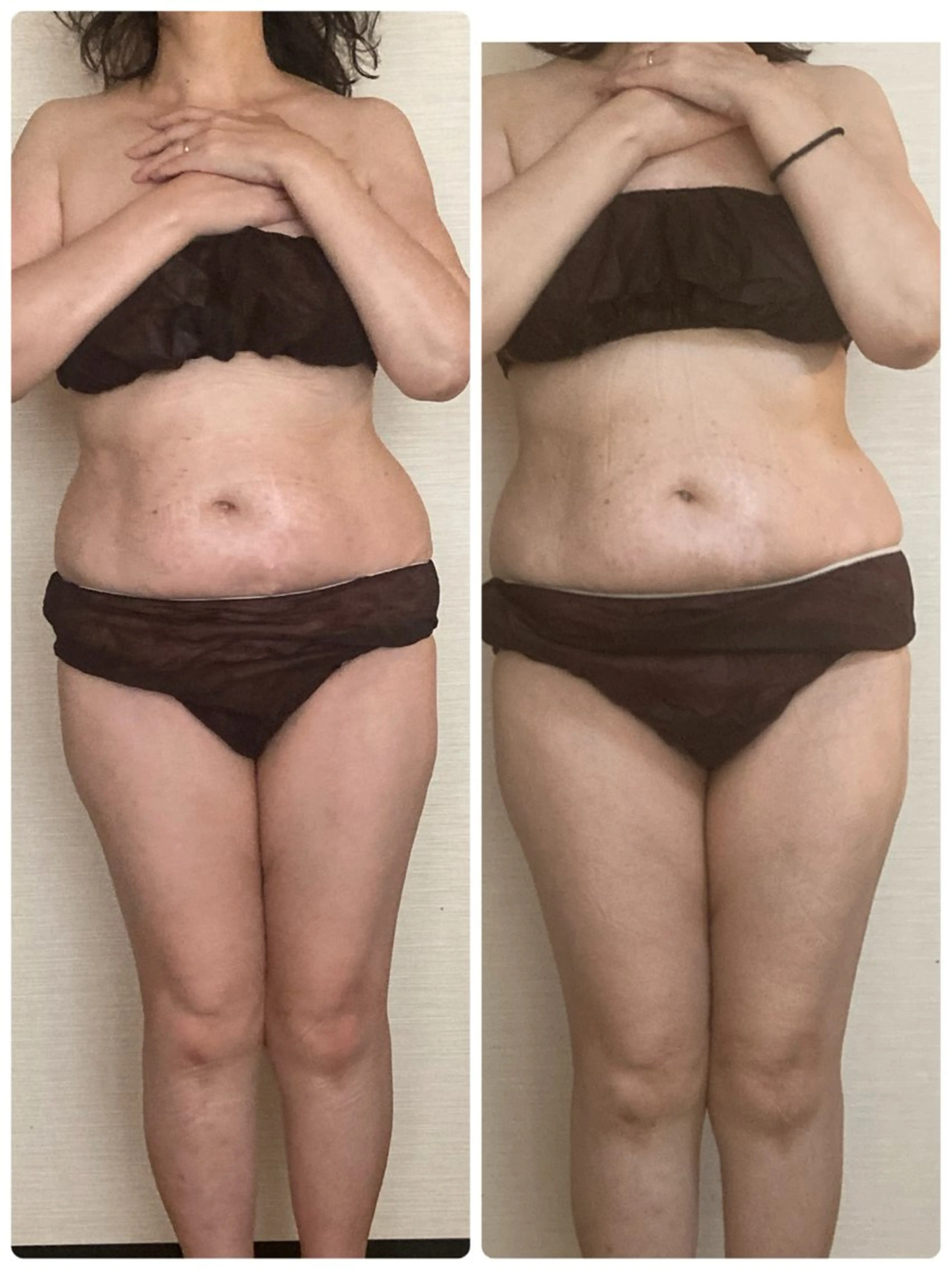 エステ リラク 宮本 しおりのエステ・リラクイメージ