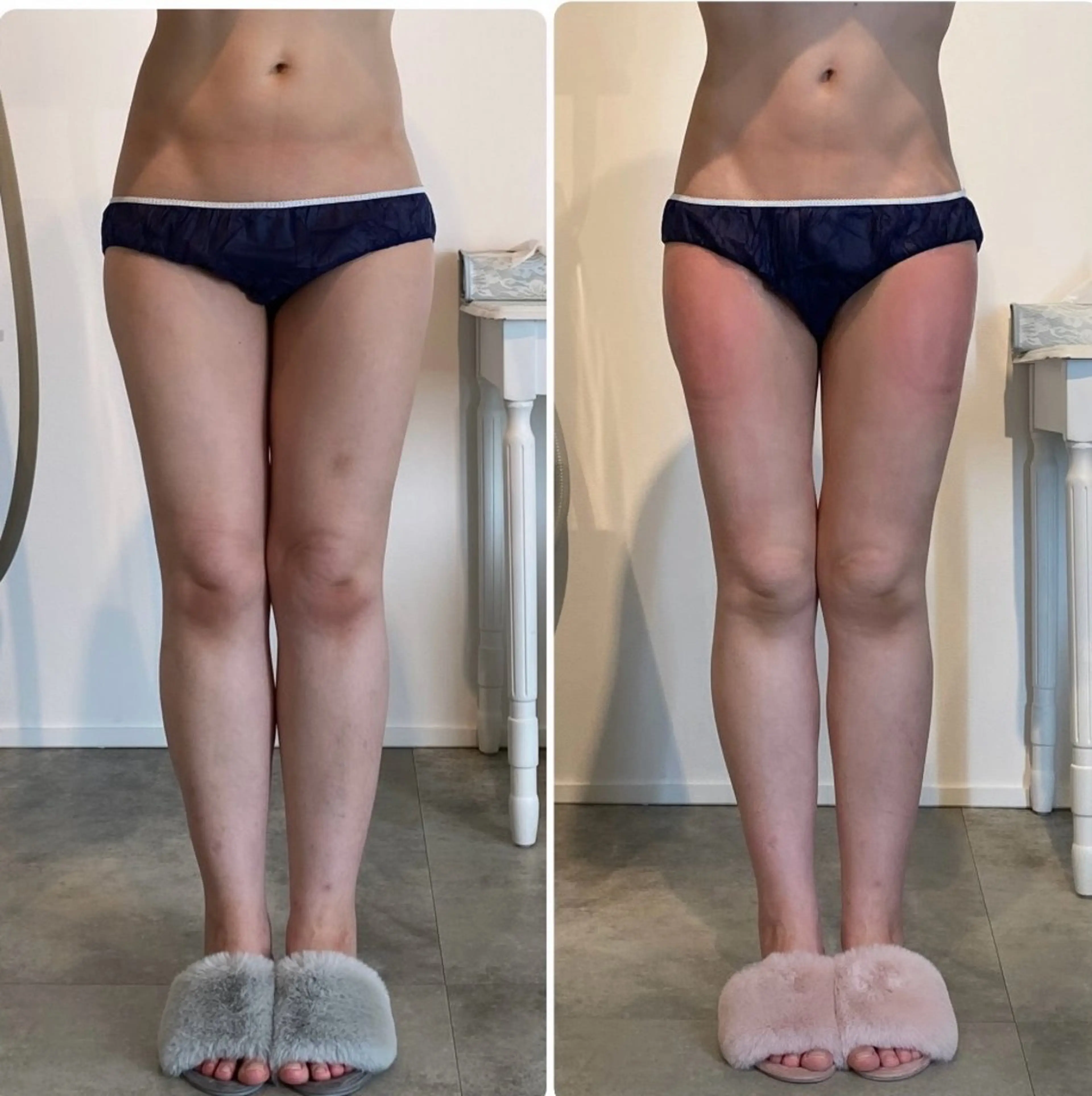 エステ 綺麗のひみつ グランプリ受賞店のエステ・リラクイメージ