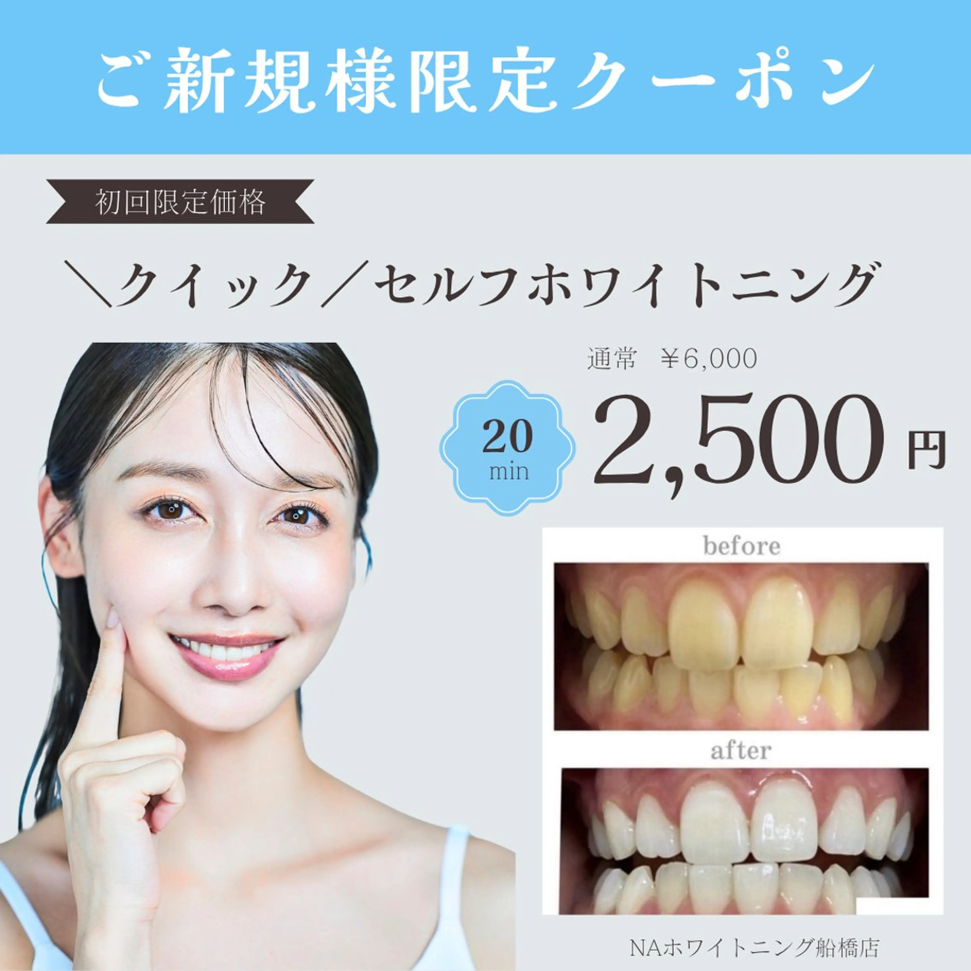 【今月限定】Google口コミで⭐︎クイック⭐︎セルフホワイトニング¥6,000→¥2500(照射時間20分)の写真