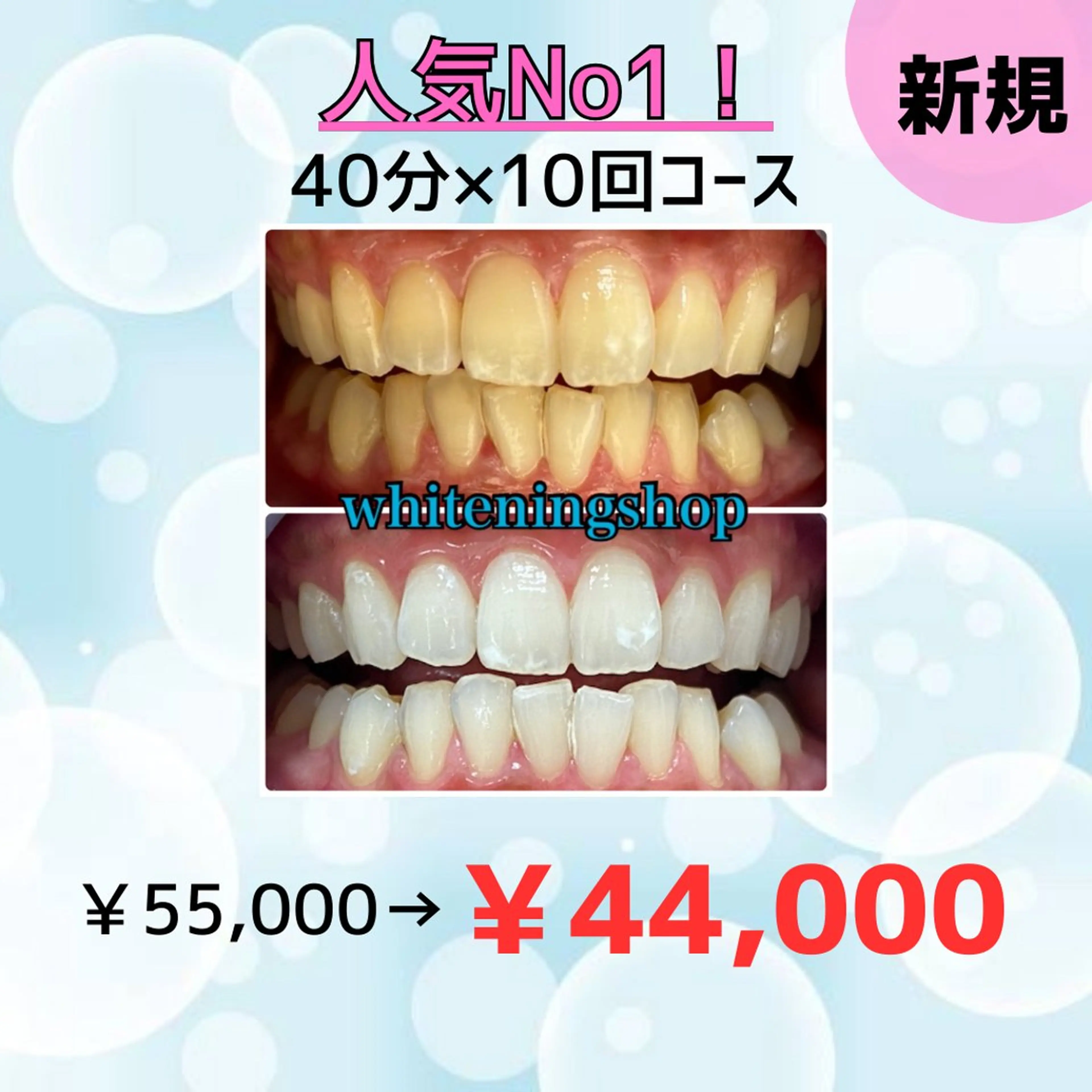 【結果重視の方に‼️】40分10回照射✨の写真