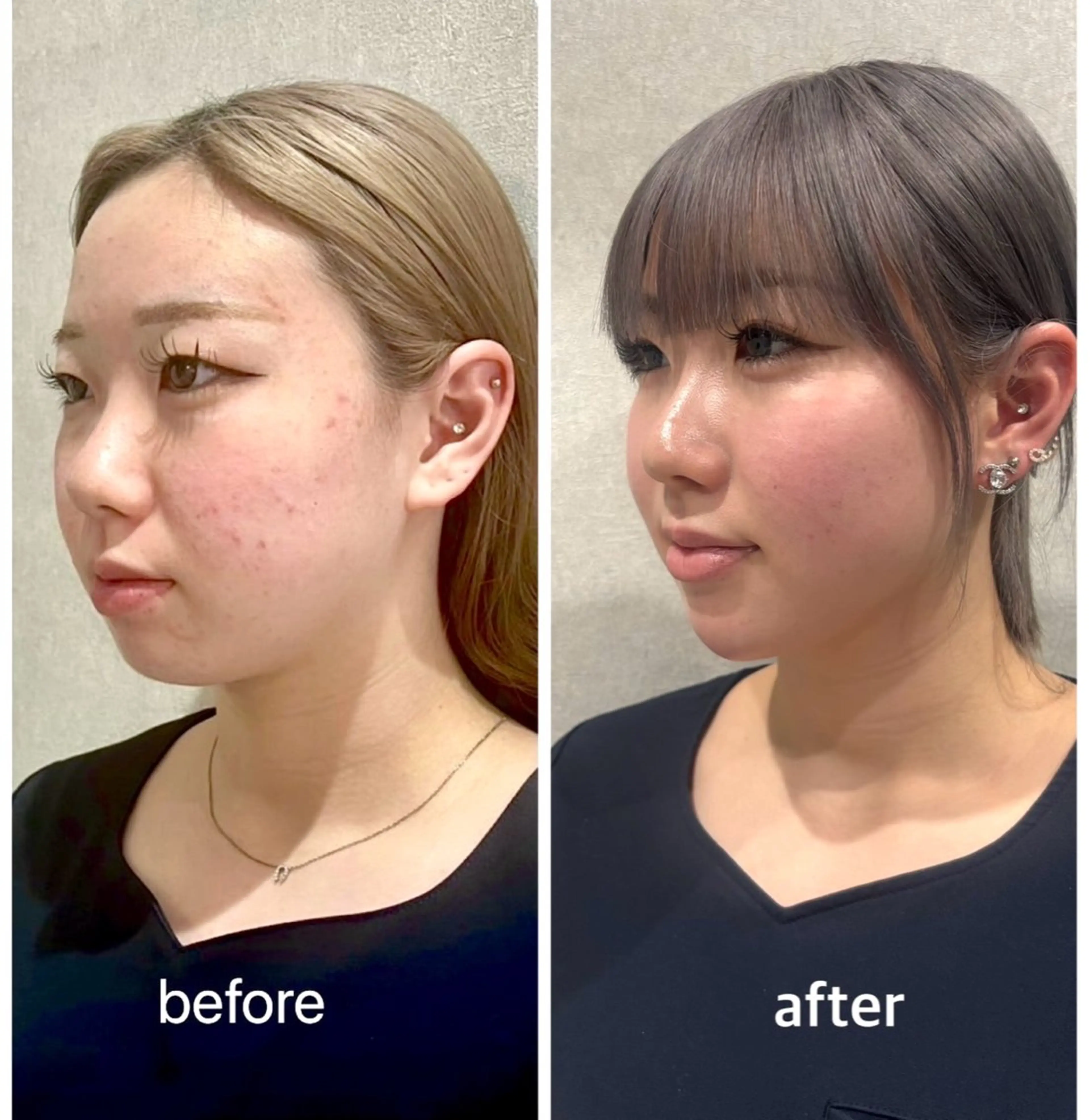 エステ sally emiry 柏店所属・sallyemiry 小顔コルギのエステ・リラクイメージ