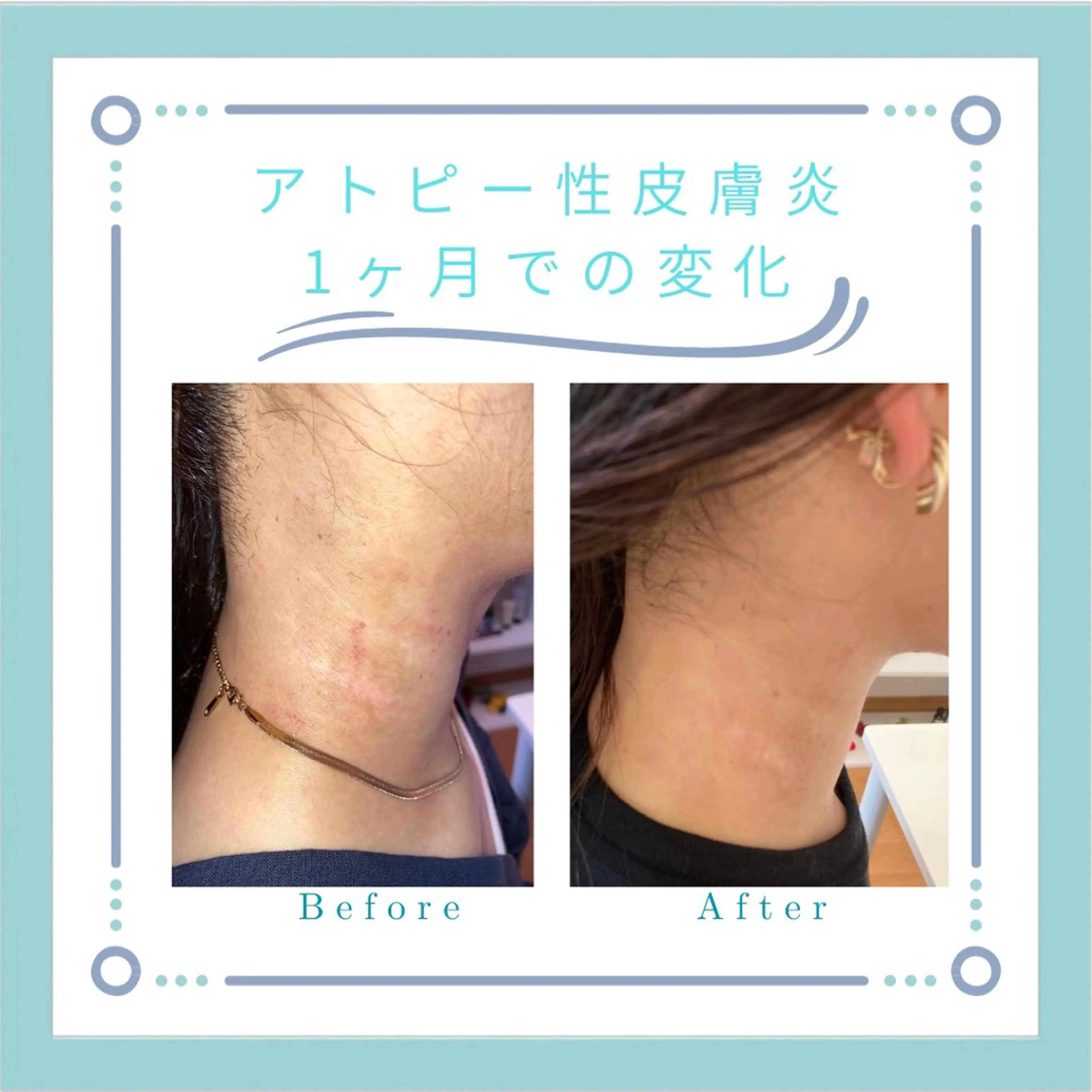 フェイシャルエステLe・Ciel所属・Le・Ciel フェイシャル&ボディのエステ・リラクイメージ