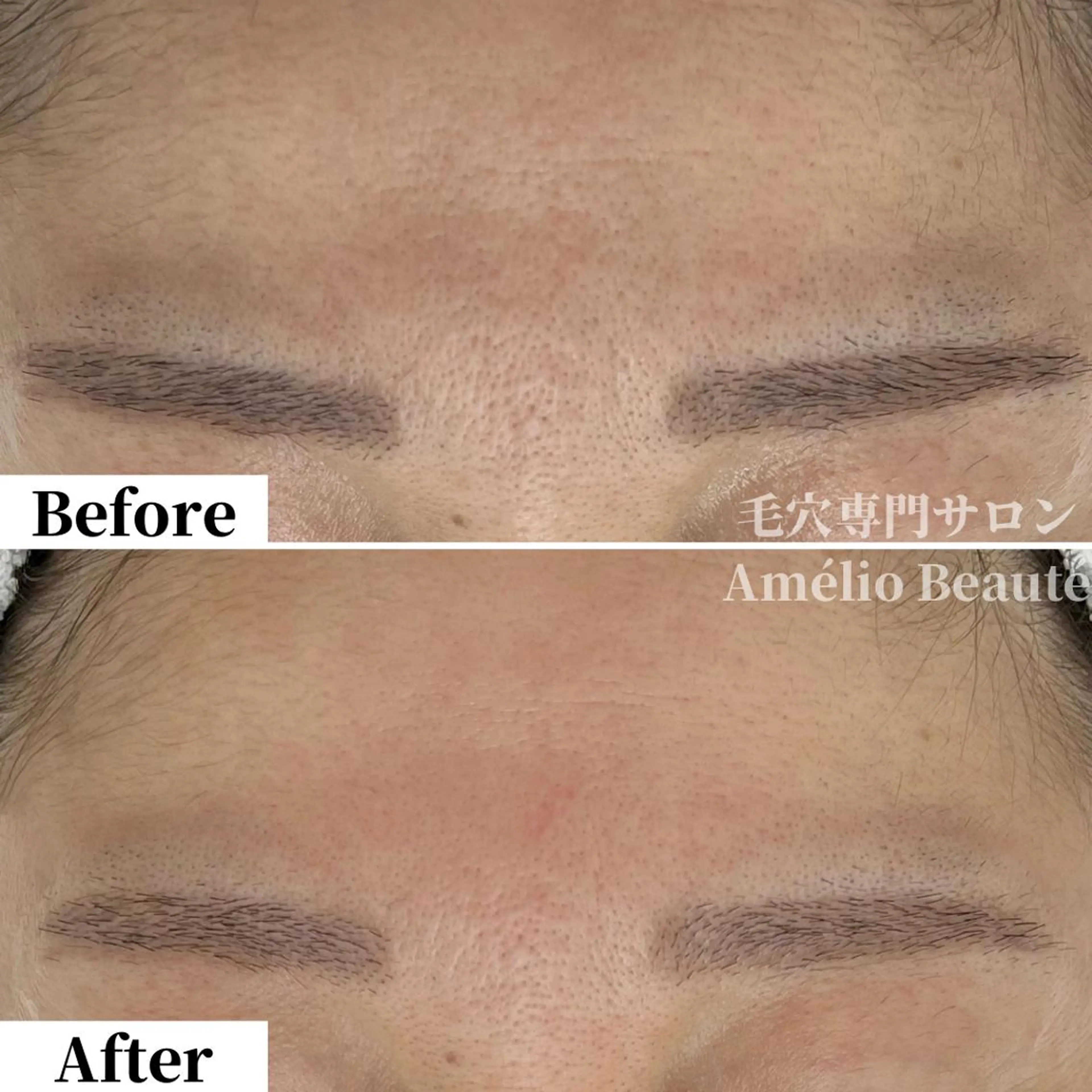 毛穴ケア専門サロン アメリオボーテのその他イメージ