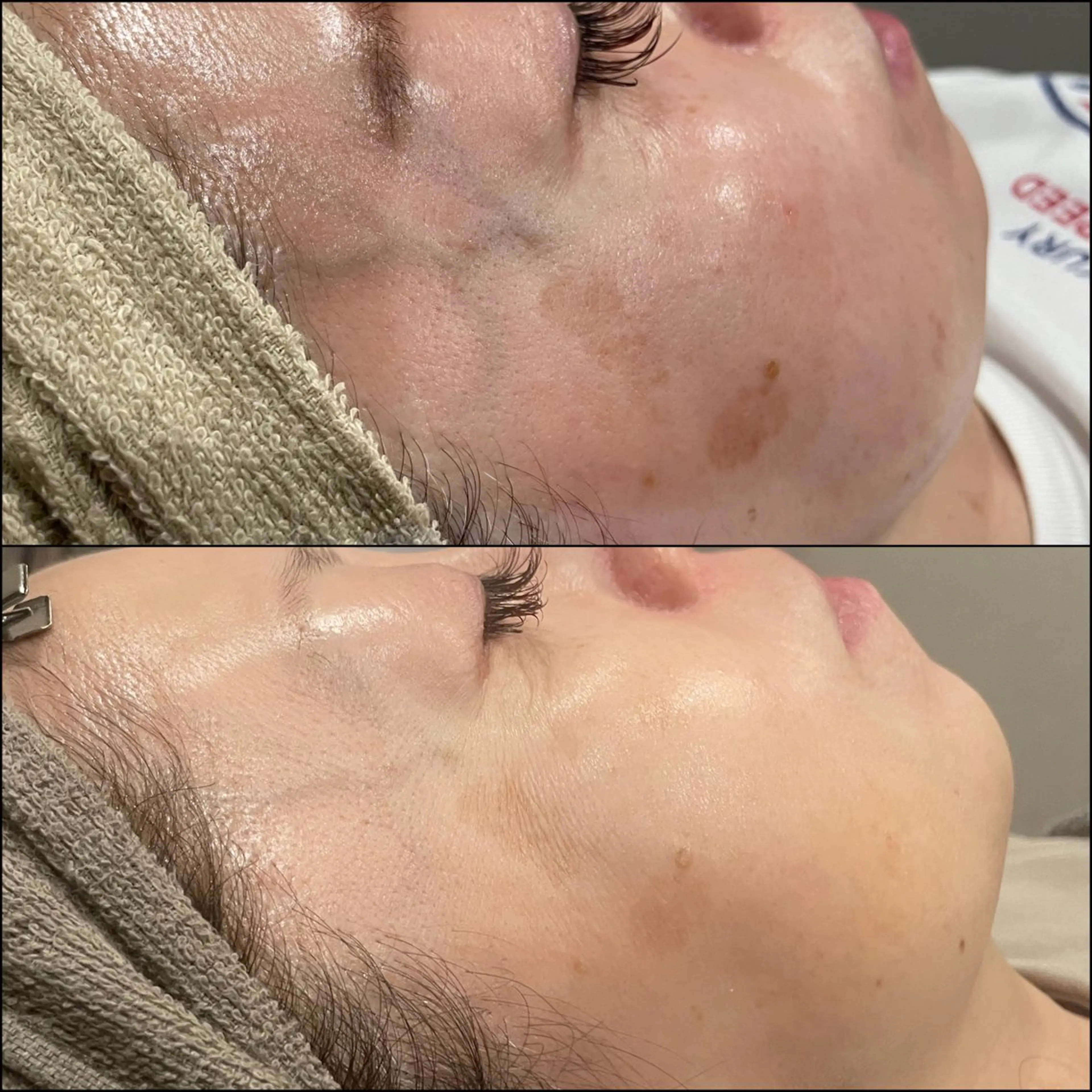 エステ LiZA エステティックサロンのエステ・リラクイメージ