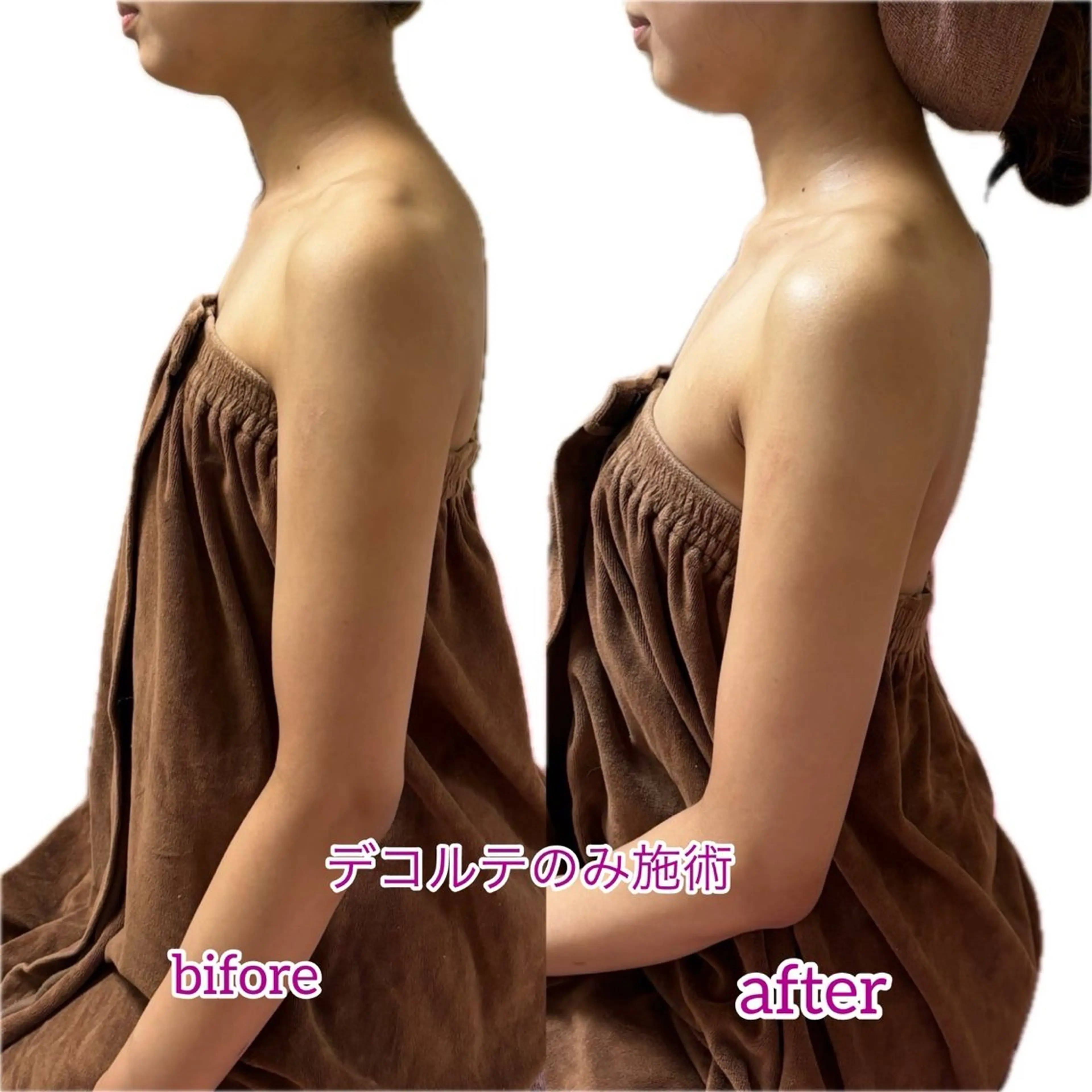 エステ リラク Linomalie エステ/たるみ/脱毛のエステ・リラクイメージ