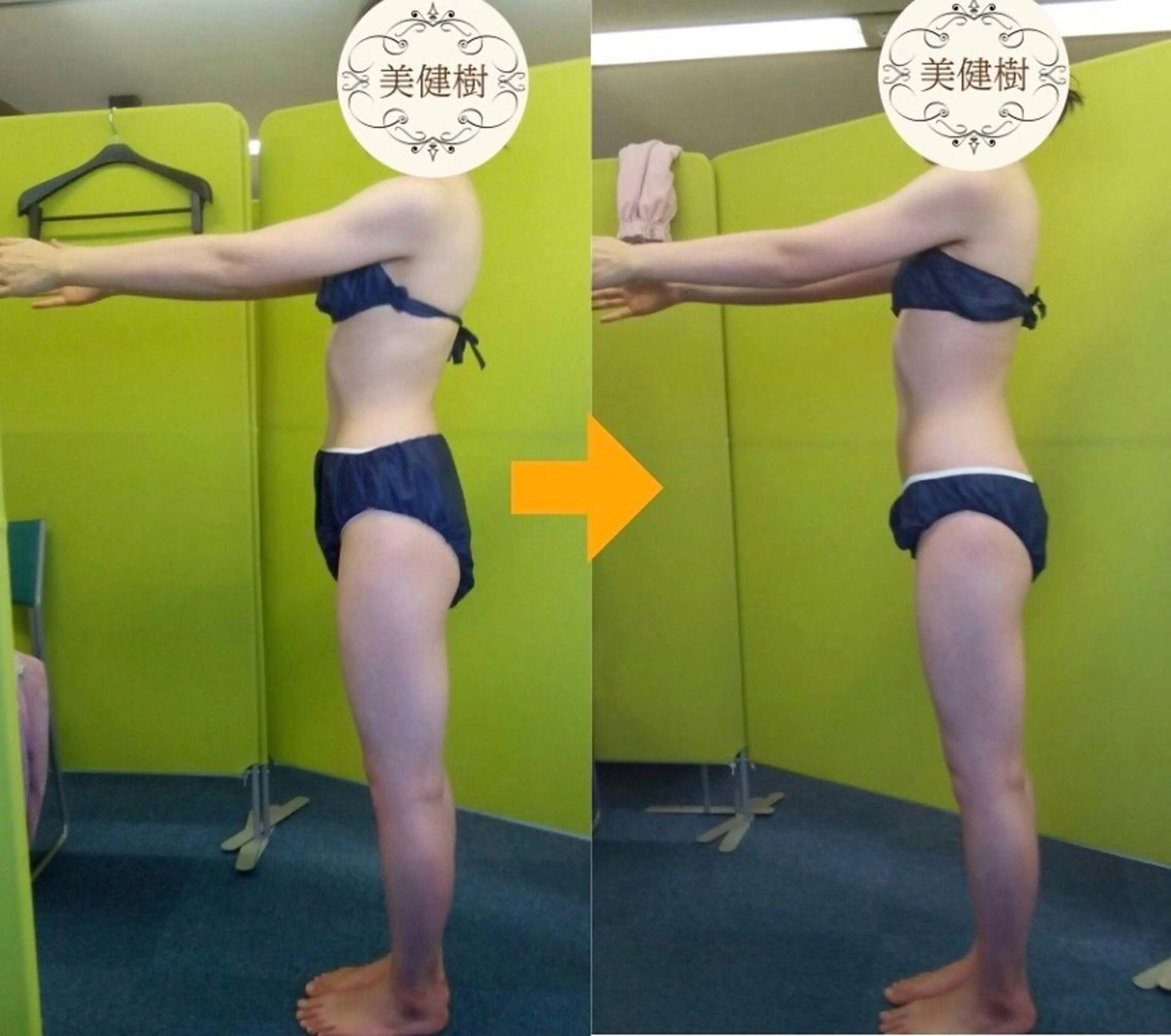 全身のリンパ節を徹底的にお掃除♪１２０分【55000円】38500円のリンパエッセンスを1本使い切ってリンパケアします。の写真