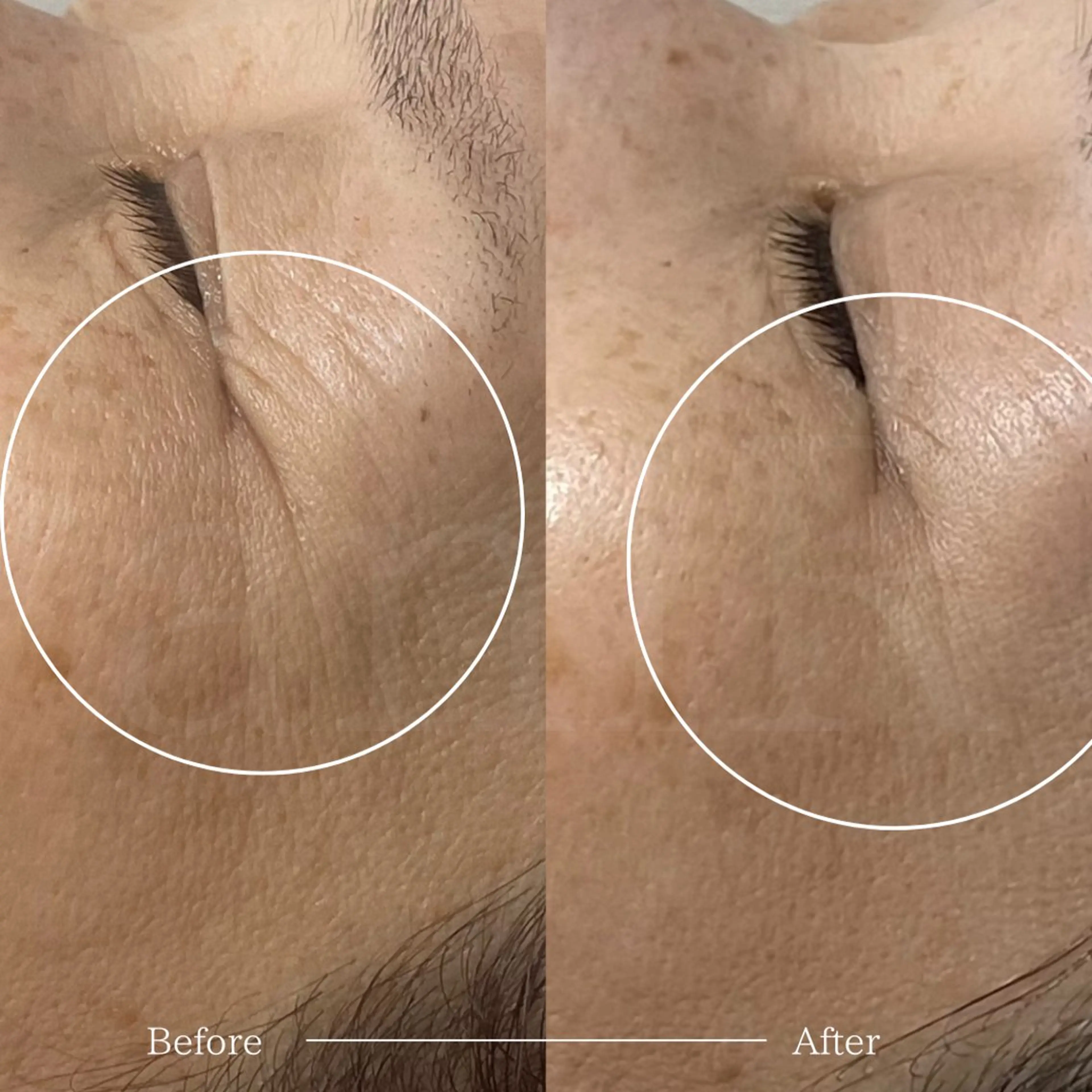 北浜/毛穴洗浄ツヤ肌 サロンaniRのエステ・リラクイメージ