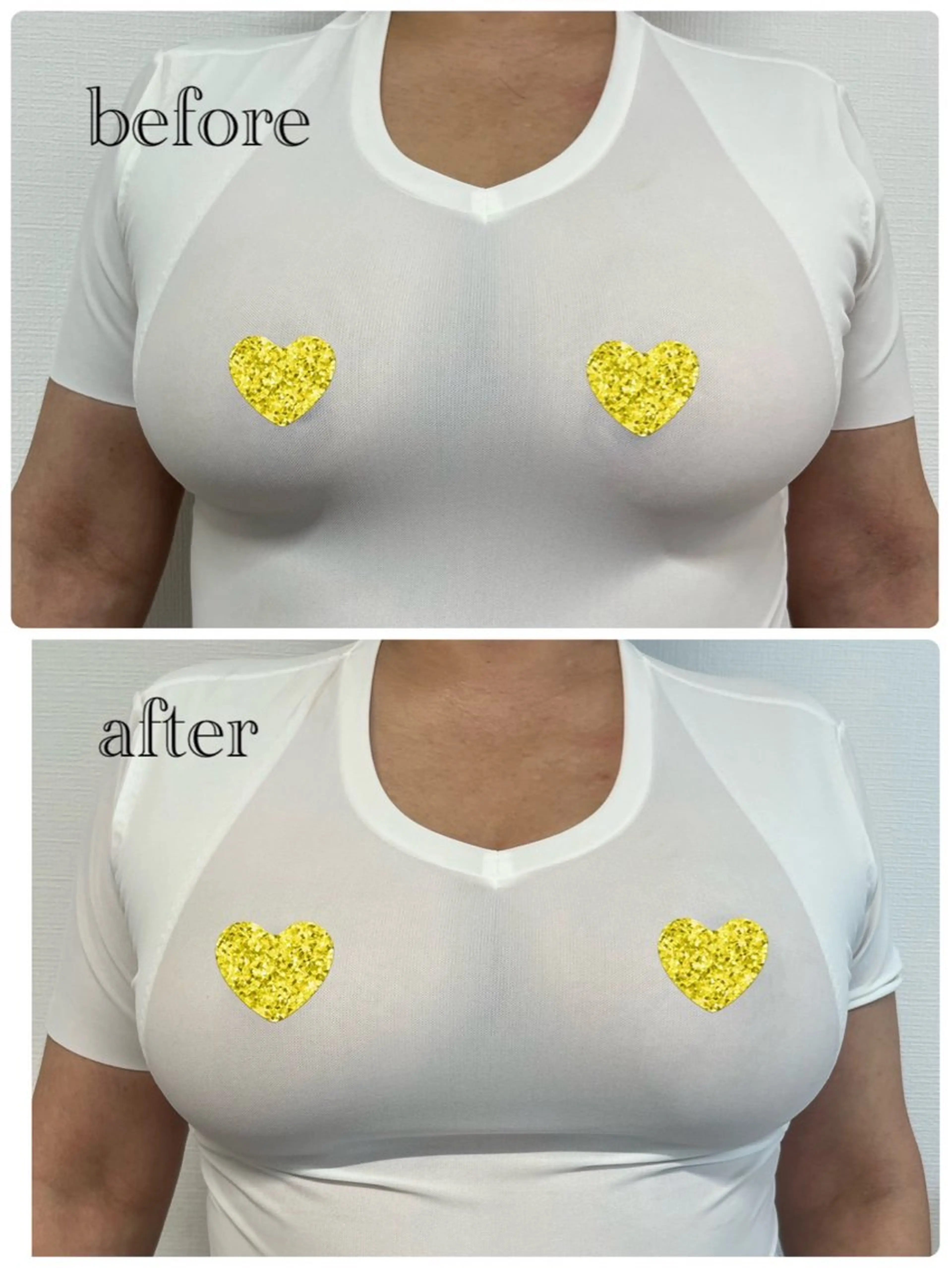 OWL 脱毛&バストケアのその他イメージ