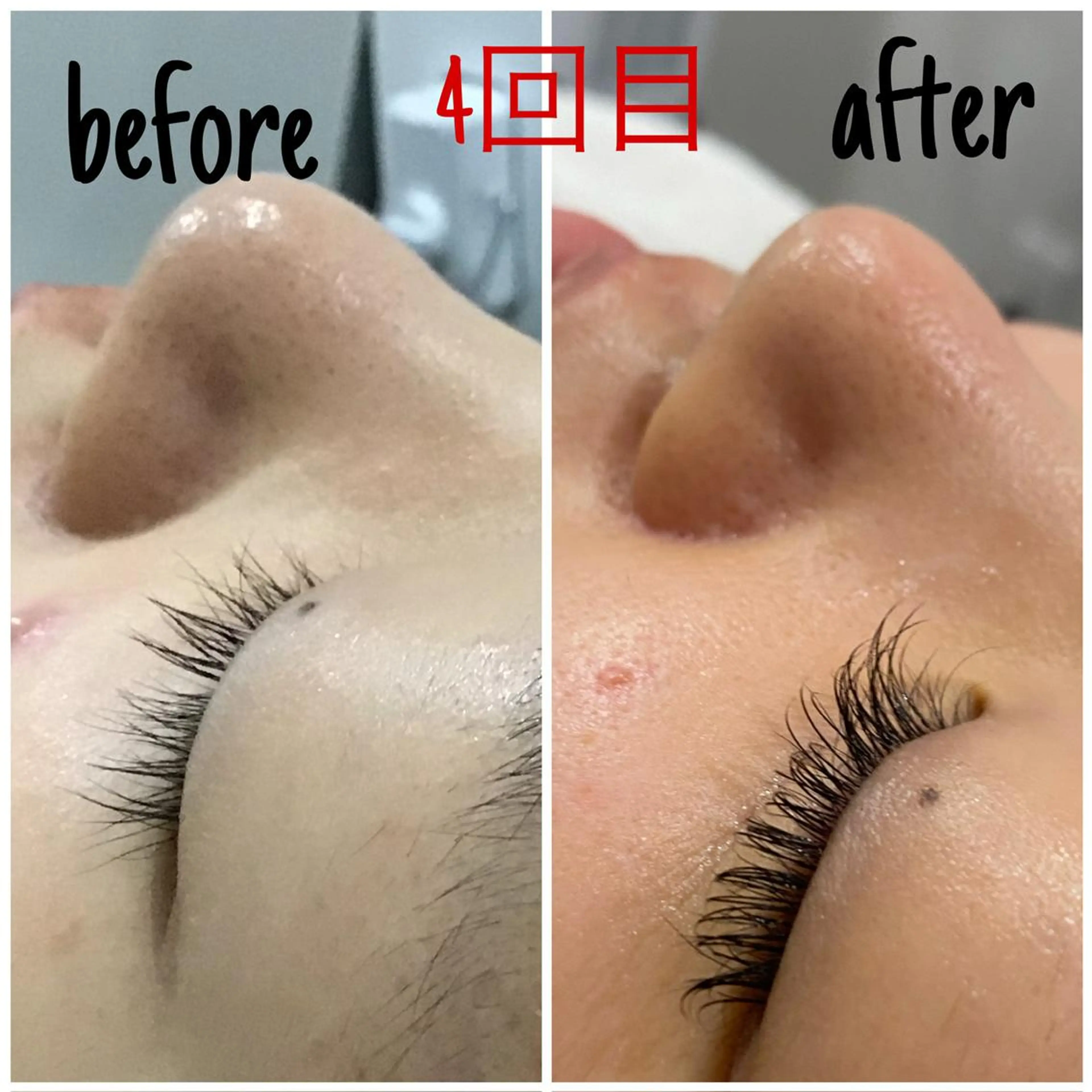 痩身/毛穴洗浄/脱毛 アルカンジュのエステ・リラクイメージ