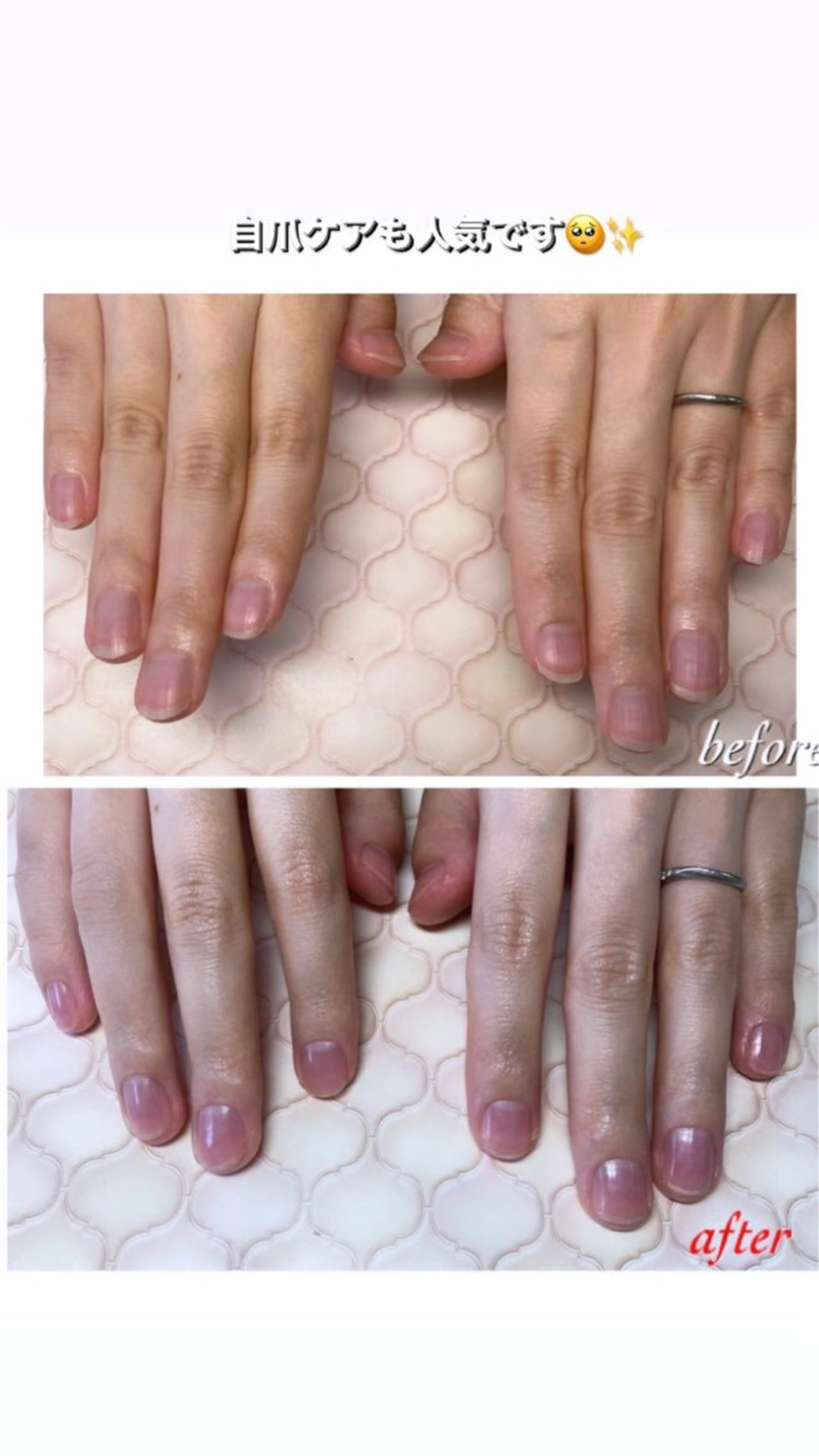 ネイル otsurunail (オツルネイル)のネイルデザイン