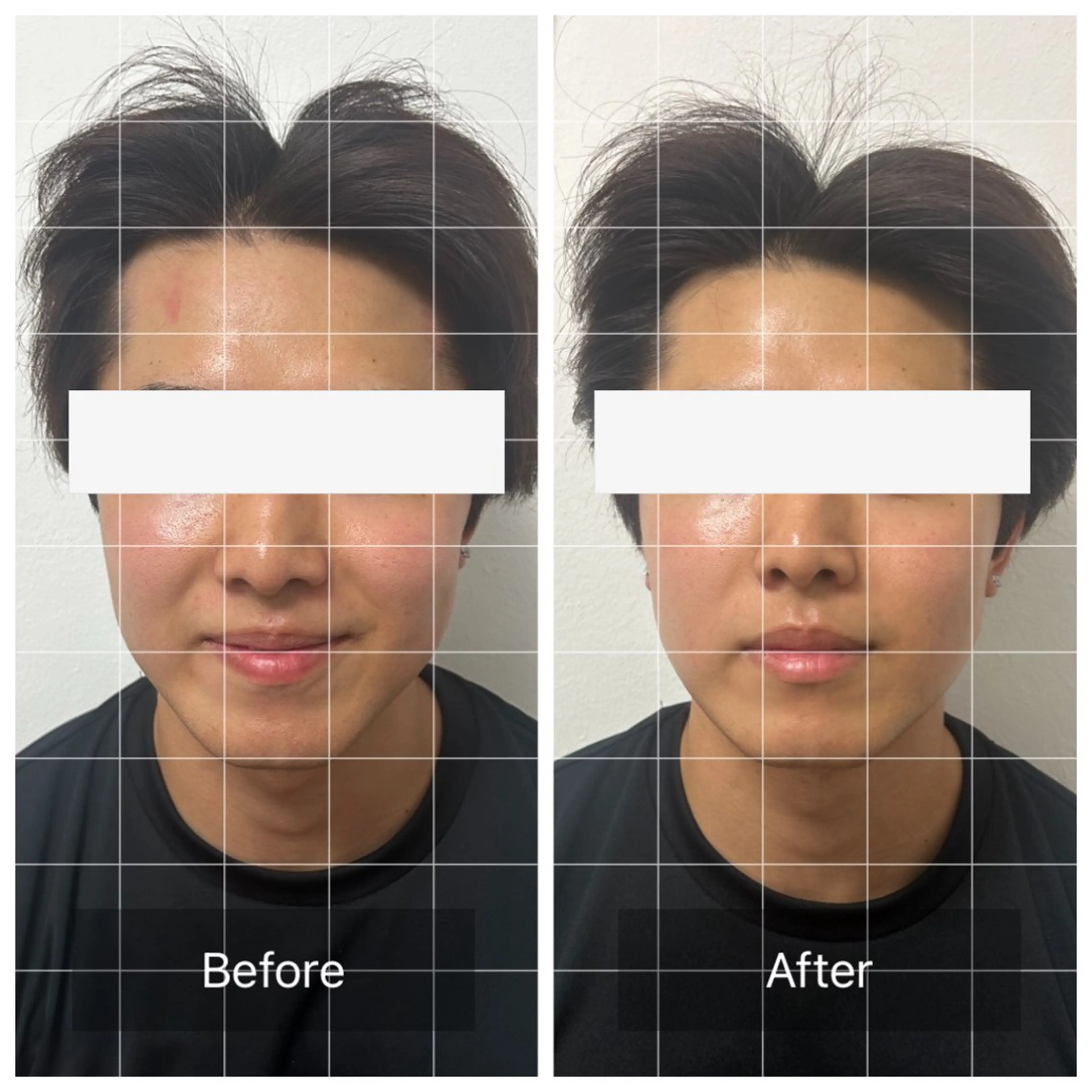 メンズ エマニエル USAのエステ・リラクイメージ