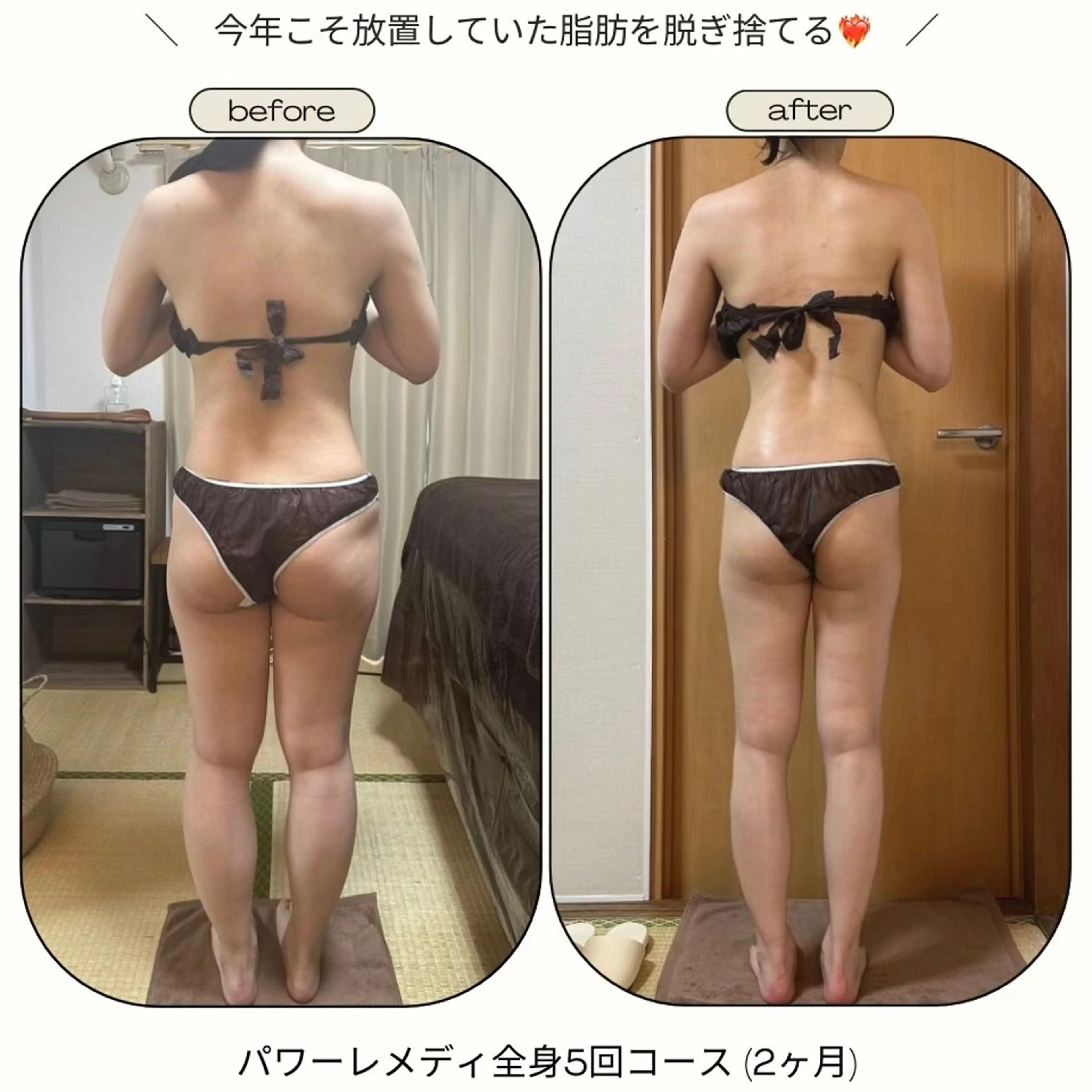 biloop所属・《本気痩せ×疲労改善 》  BILOOPのエステ・リラクイメージ