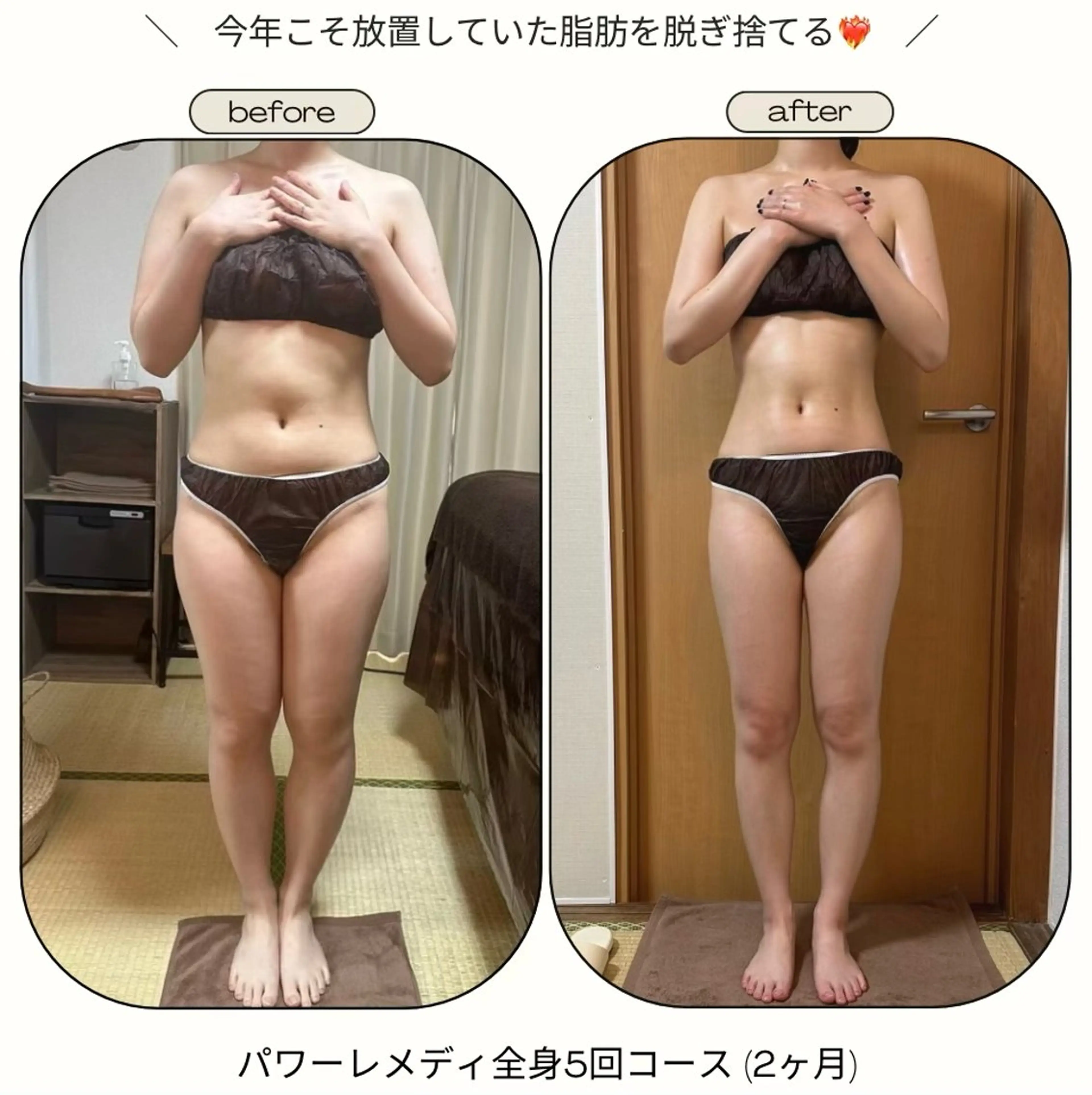 biloop所属・《本気痩せ×疲労改善 》  BILOOPのエステ・リラクイメージ