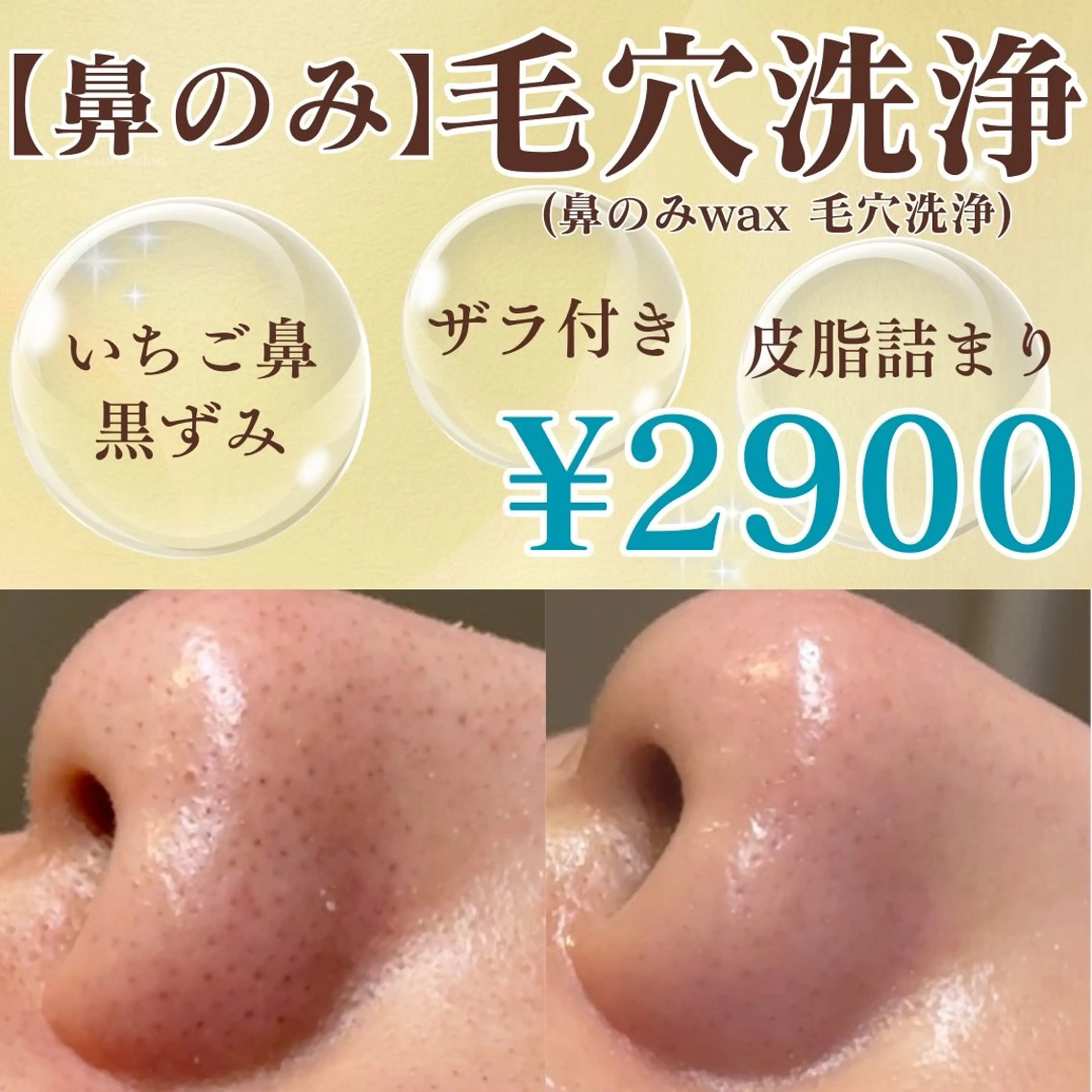 【🍓👃🏻いちご鼻卒業👃🏻🍓】徹底毛穴ケア!!鼻のみ毛穴洗浄×毛穴引き締めパック🧴の写真