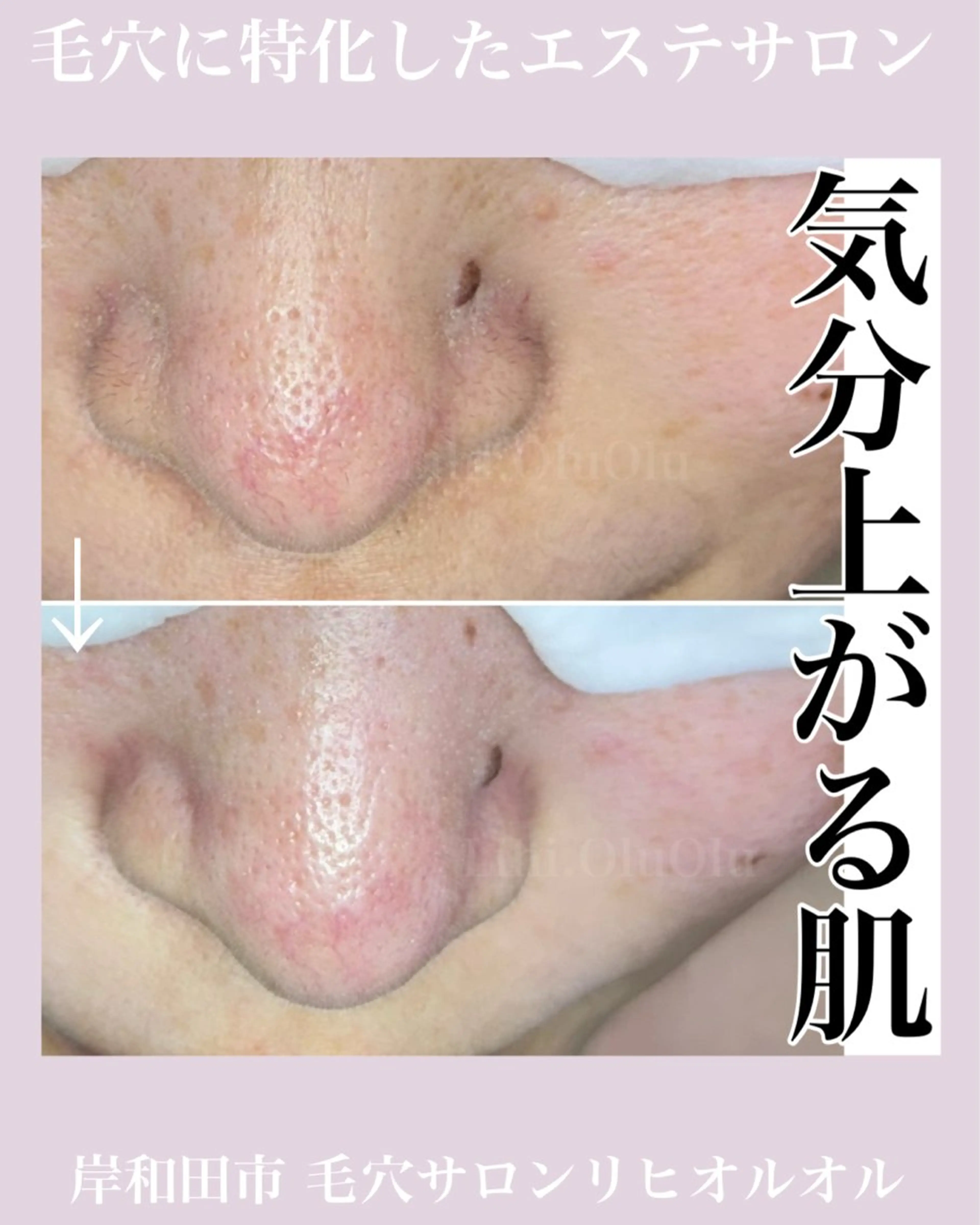 毛穴汚れ改善専門店/ 岸和田/リヒオルオルのエステ・リラクイメージ