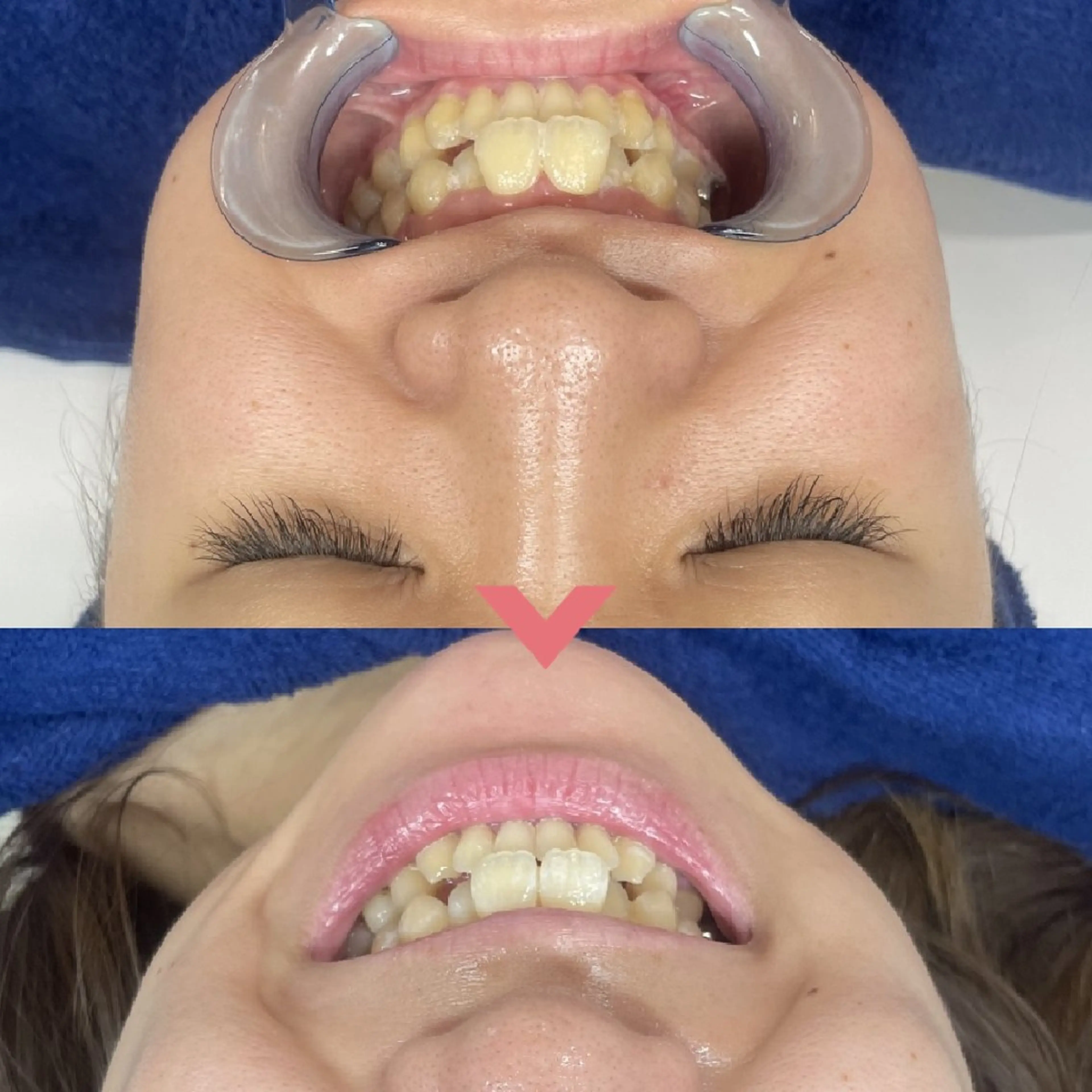 🎀Luana🎀 トータルビューティーのエステ・リラクイメージ